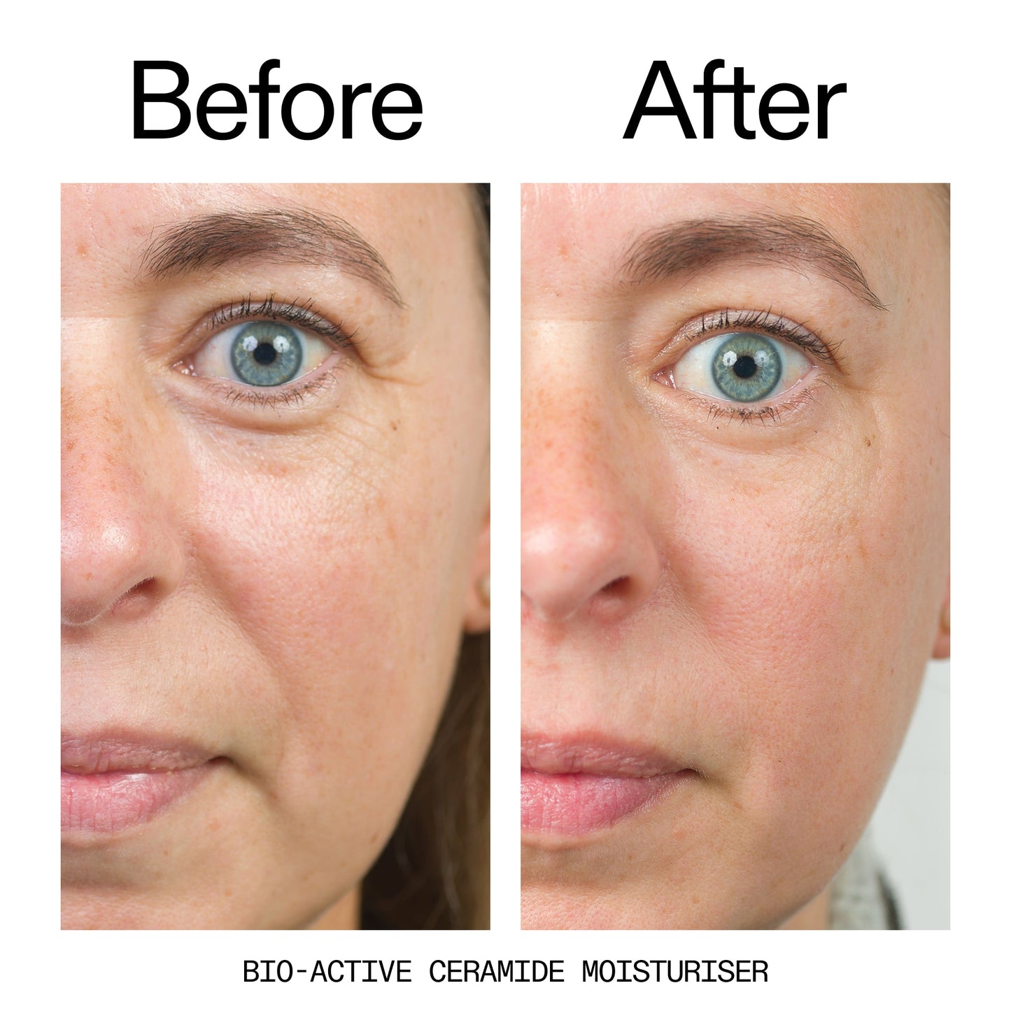 barrier-boosting-trio-h4 Bio-Active_Before_After_2000x2000_600947b4-e8c5-425a-9155-fc15bc83aa12.jpg