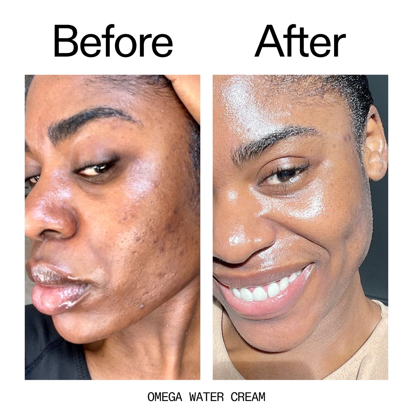 hydrating-cleanser-and-moisturizer-duo-b5 Omega_Water_Cream_Before_After_2000x2000_8e88278b-8c8d-48dc-ac77-4e98ebbd1b77.jpg
