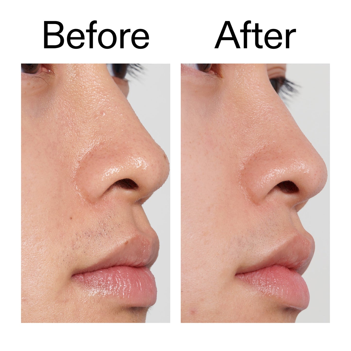 pha-toner-c0 PHA_Toner_Before_After_2000x2000_e3c10172-0150-4342-8b95-57417eaff50d.jpg