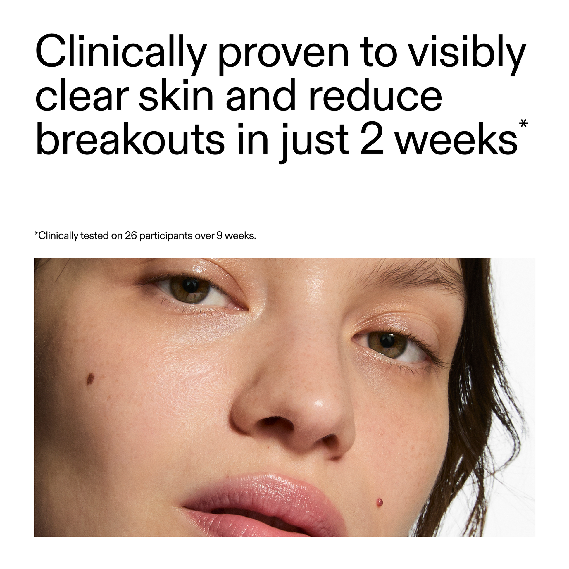 360-acne-clearing-serum-h0 360_Serum_Key_Claim.png