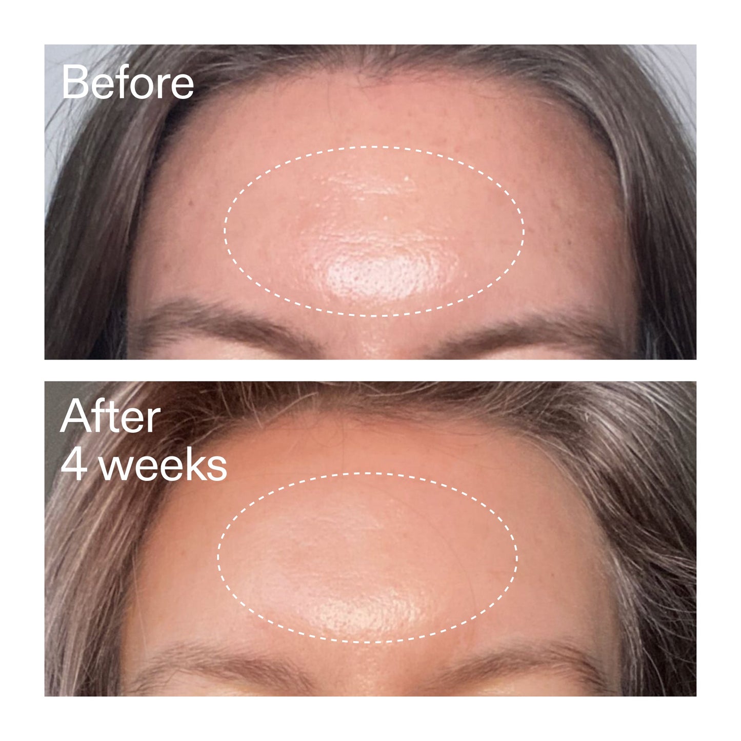 advanced-0-2-retinal-serum-duo-u1 AdvancedRetinal_BeforeAfter1_2000x2000_4e9c798a-f30e-45b8-a34a-7c4740f2f2cb.jpg