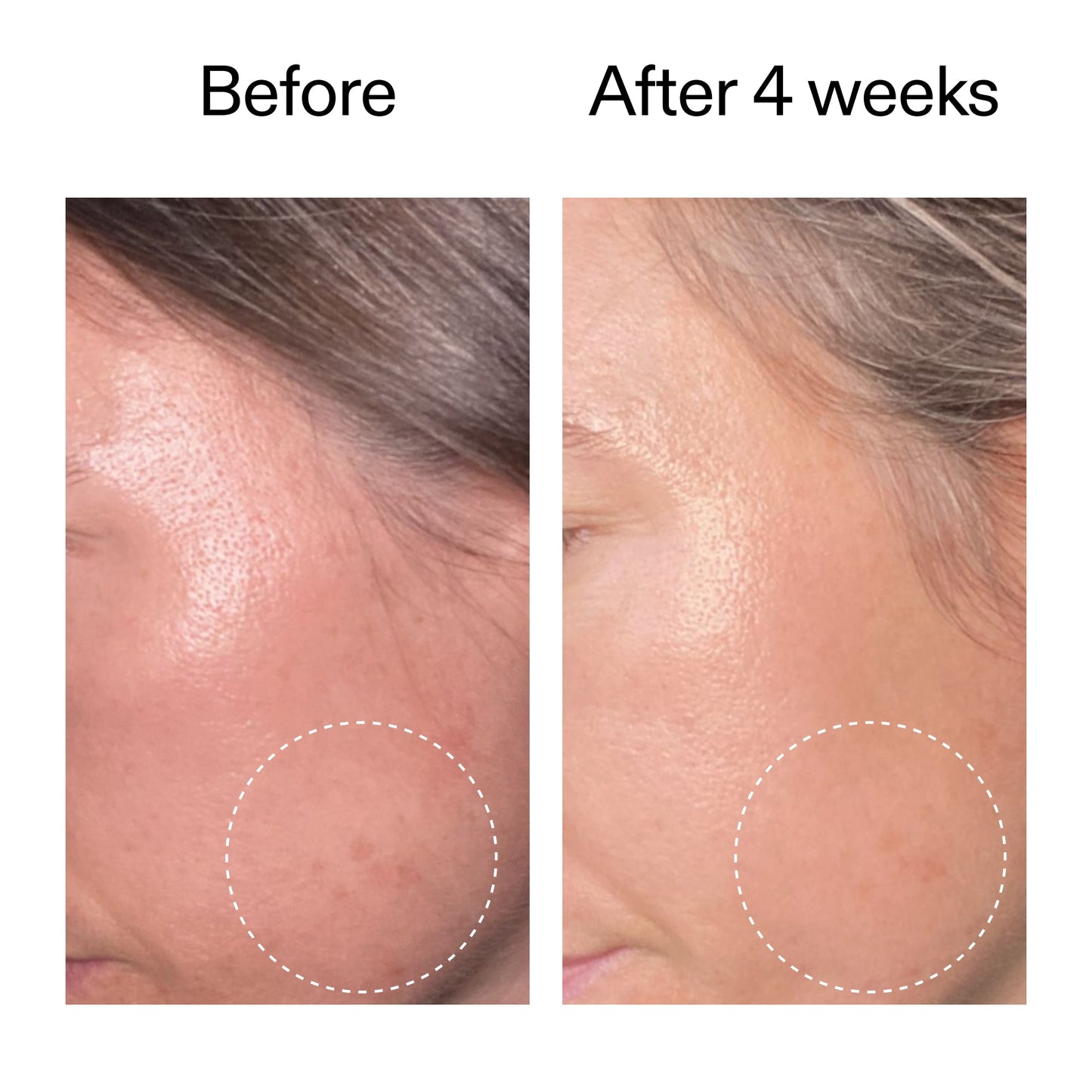 advanced-0-2-retinal-serum-h3 AdvancedRetinal_BeforeAfter2__2000x2000_62fb16bb-77ae-4d63-8500-88dbf847f4b9.jpg