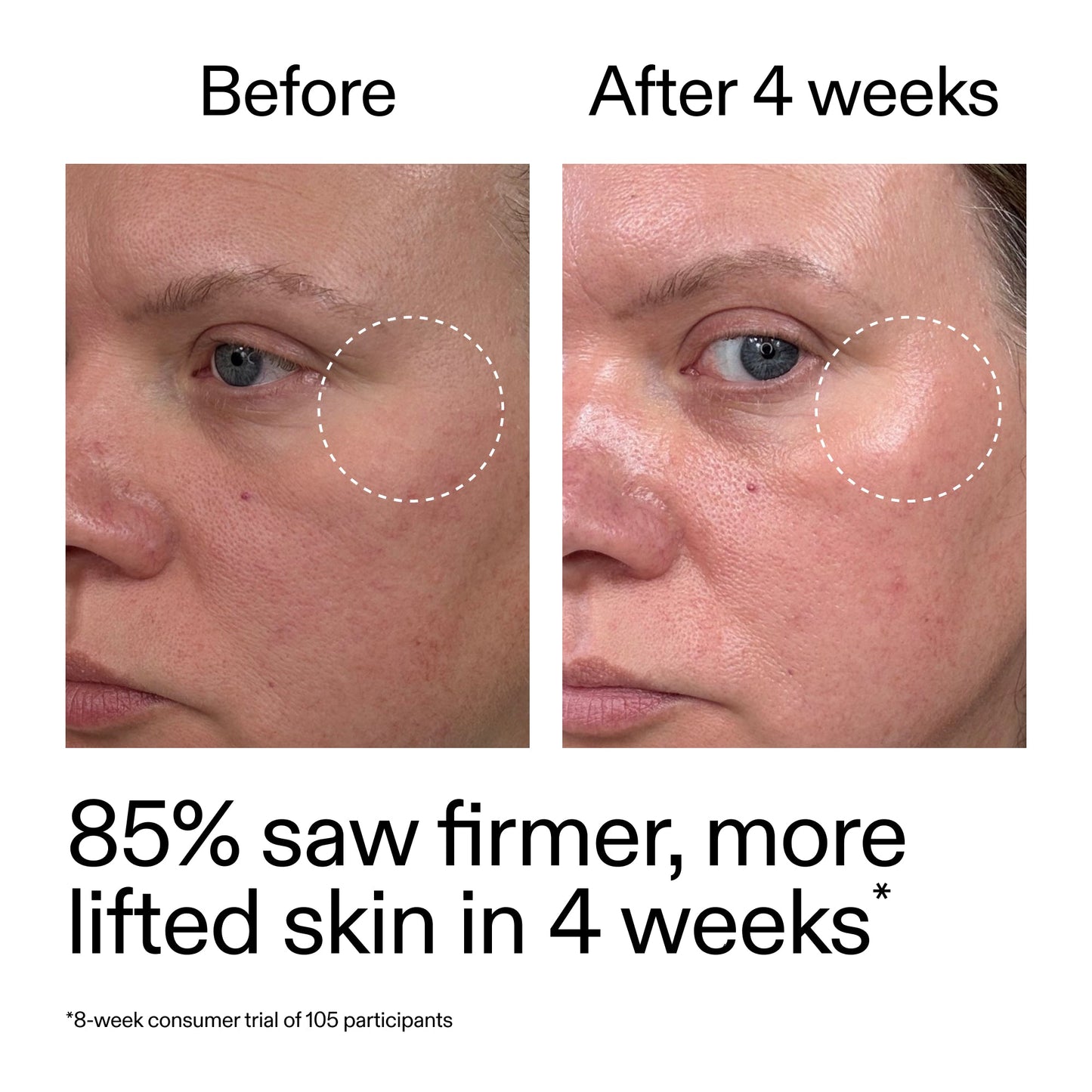advanced-0-2-retinal-serum-duo-u1 AdvancedRetinal_BeforeAfter_Claim1_2000x2000_3a315aa8-f408-4b33-bbeb-0d9209f98404.jpg