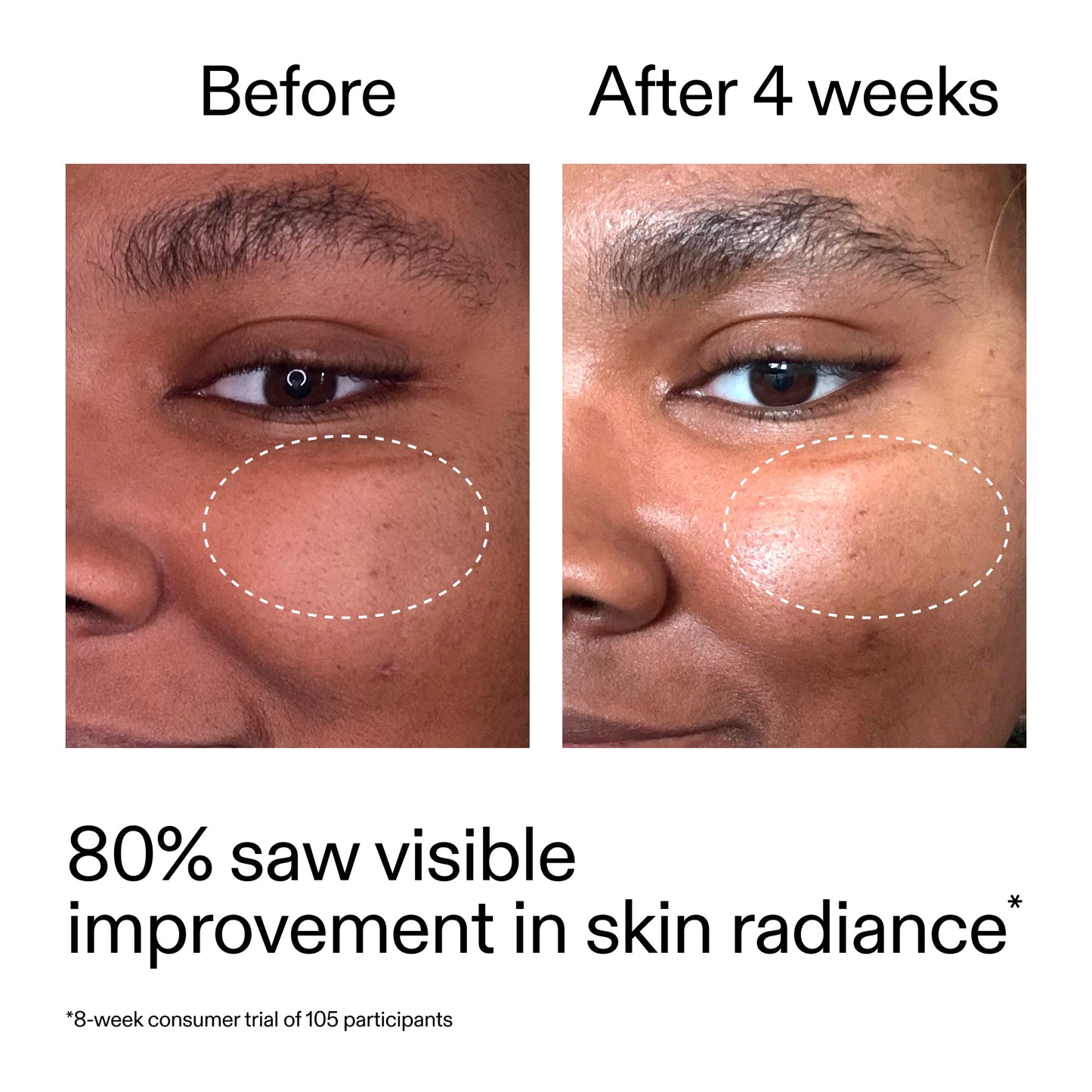 advanced-0-2-retinal-serum-duo-u1 AdvancedRetinal_BeforeAfter_Claim2_2000x2000_681b621d-8d44-4d44-9a40-89244f9b2e53.jpg