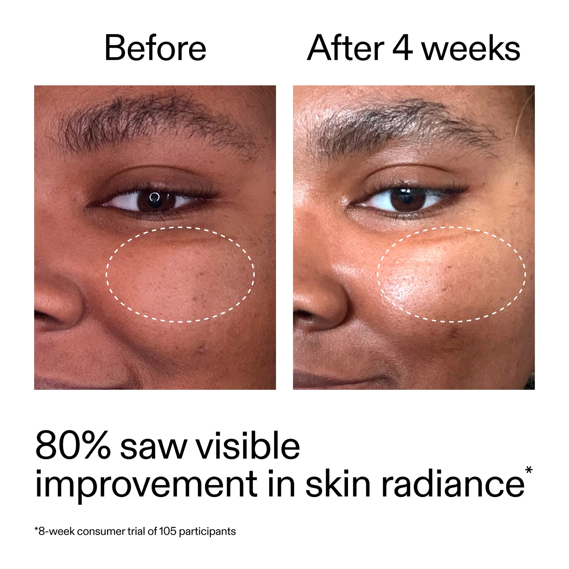 advanced-0-2-retinal-serum-duo-u1 AdvancedRetinal_BeforeAfter_Claim2_2000x2000_681b621d-8d44-4d44-9a40-89244f9b2e53.jpg