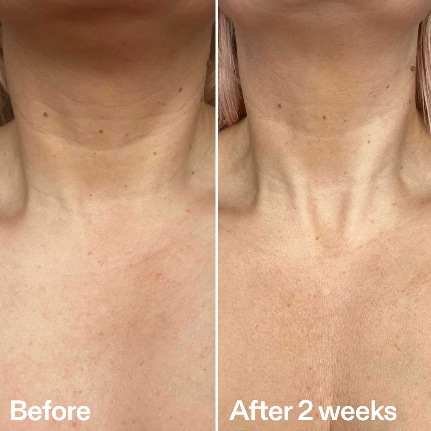 bio-active-neck-lift-stick-w7 B_A_2.jpg