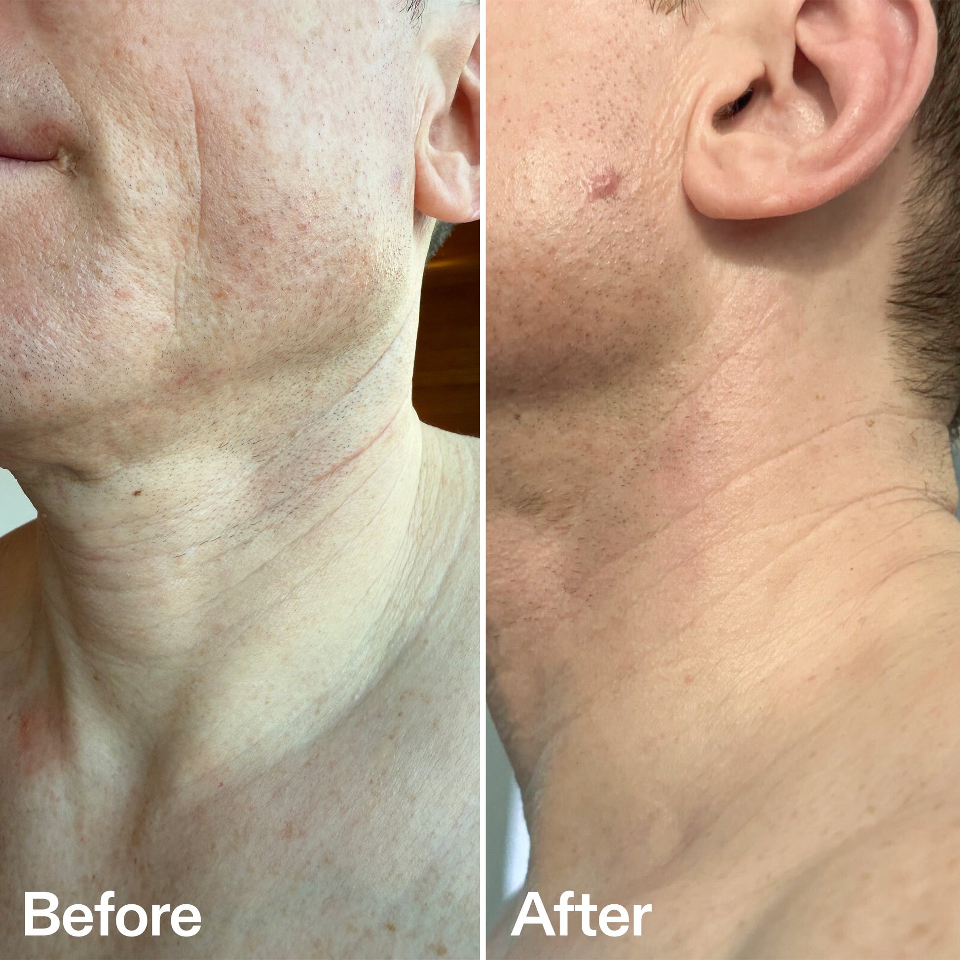bio-active-neck-lift-stick-w7 B_A_afa2743e-b8e2-4504-92f4-e281cb6cf759.jpg