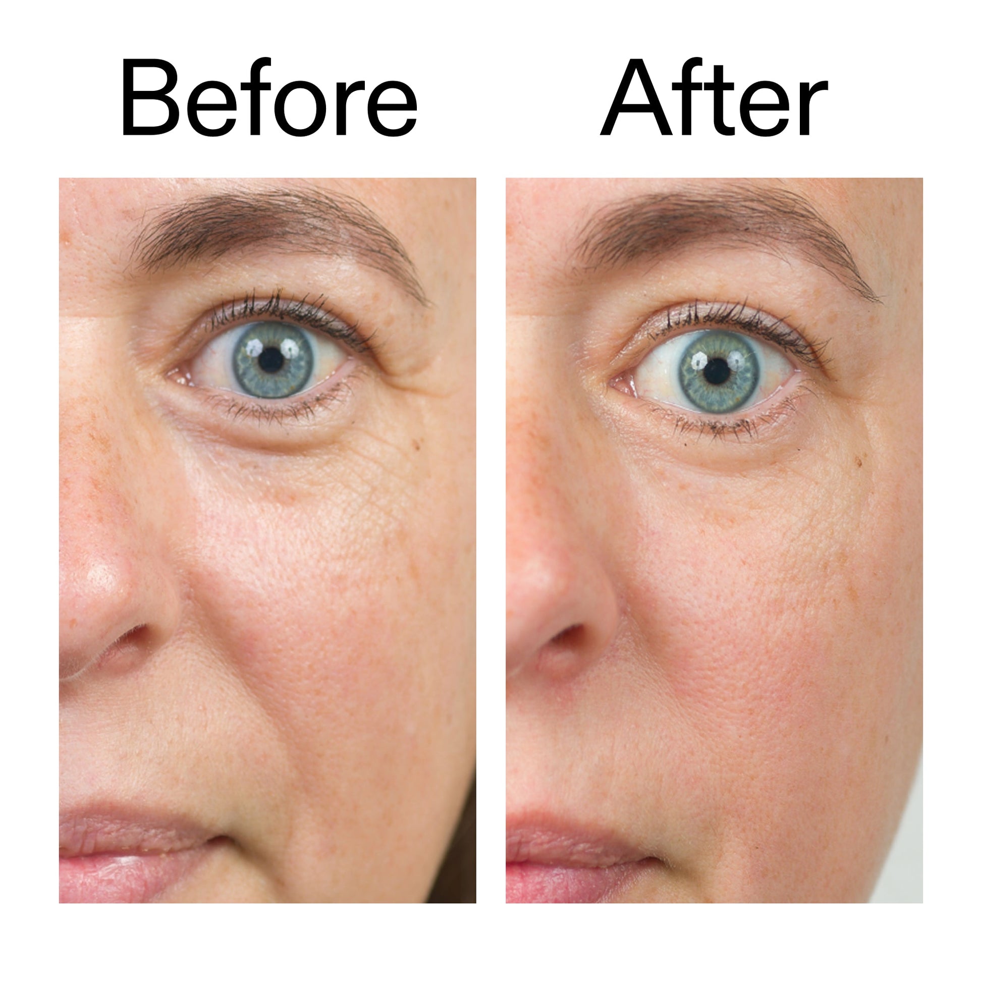 bio-active-ceramide-moisturizer-k0 Bio-Active_Before_After_2000x2000_566e5a9e-135e-417a-8242-b44e5fa35463.jpg