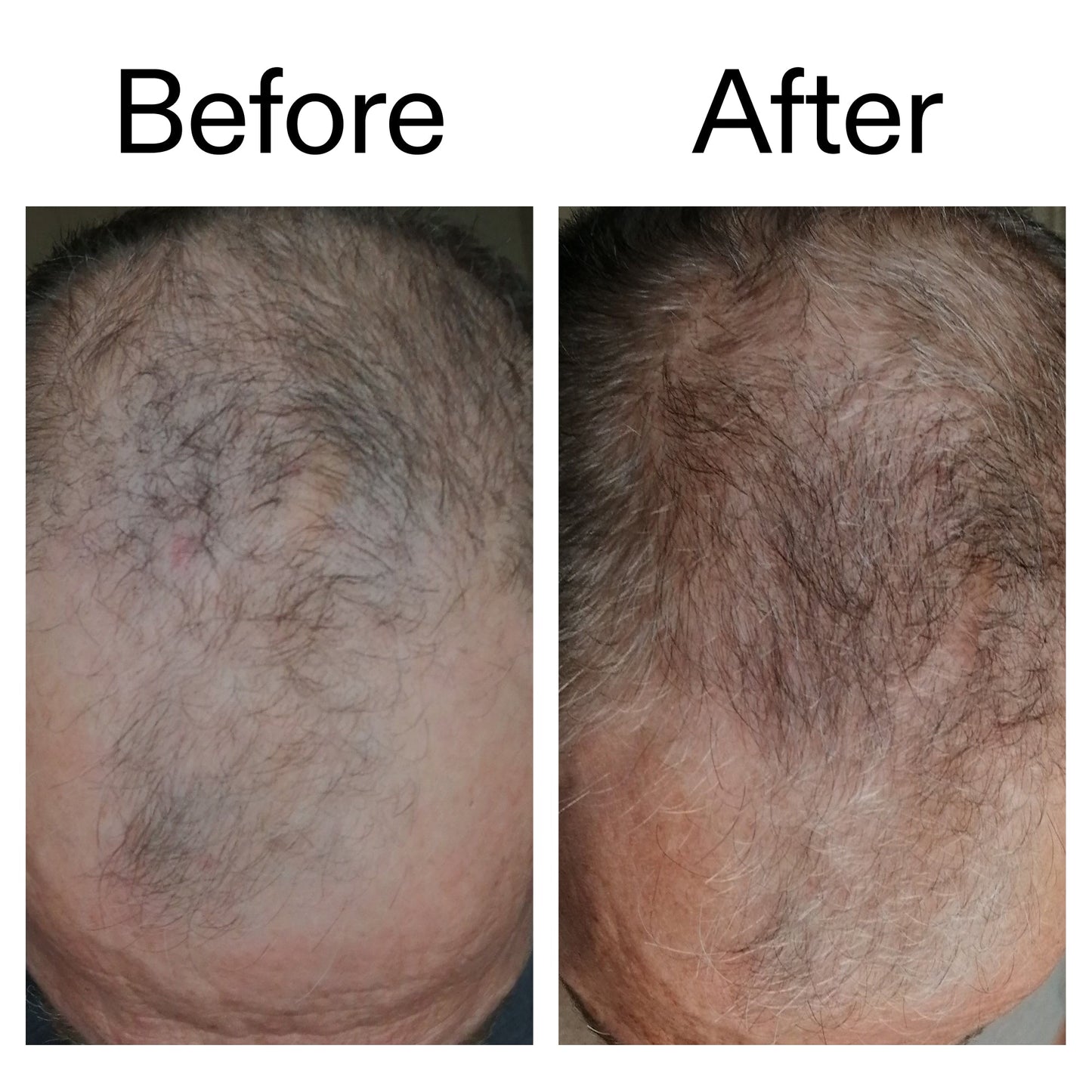 caffeine-stimulating-scalp-treatment-k8 Caffeine_Scalp_Treatment_B_A_Ppage_2000_x_2000.jpg