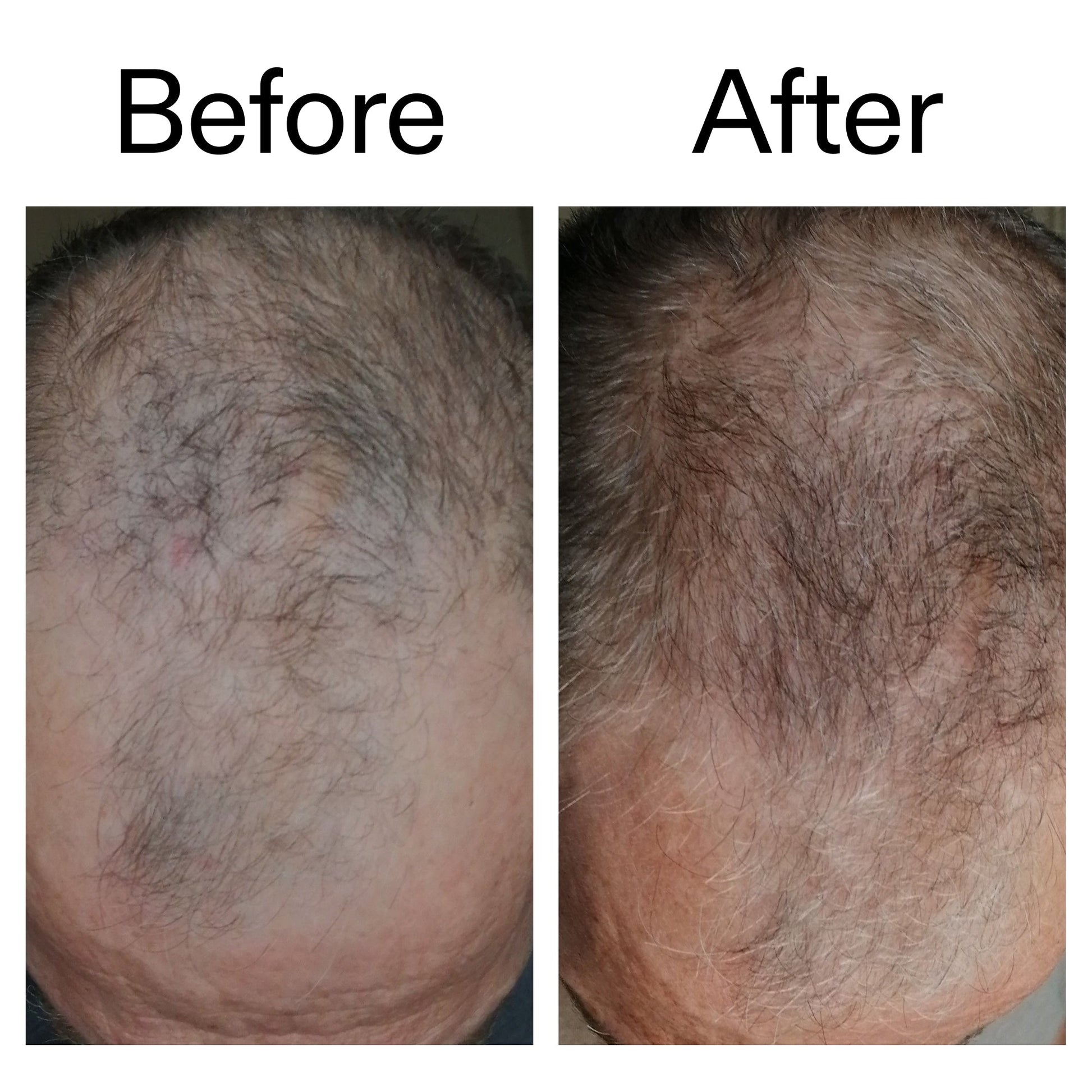 caffeine-stimulating-scalp-treatment-k8 Caffeine_Scalp_Treatment_B_A_Ppage_2000_x_2000.jpg