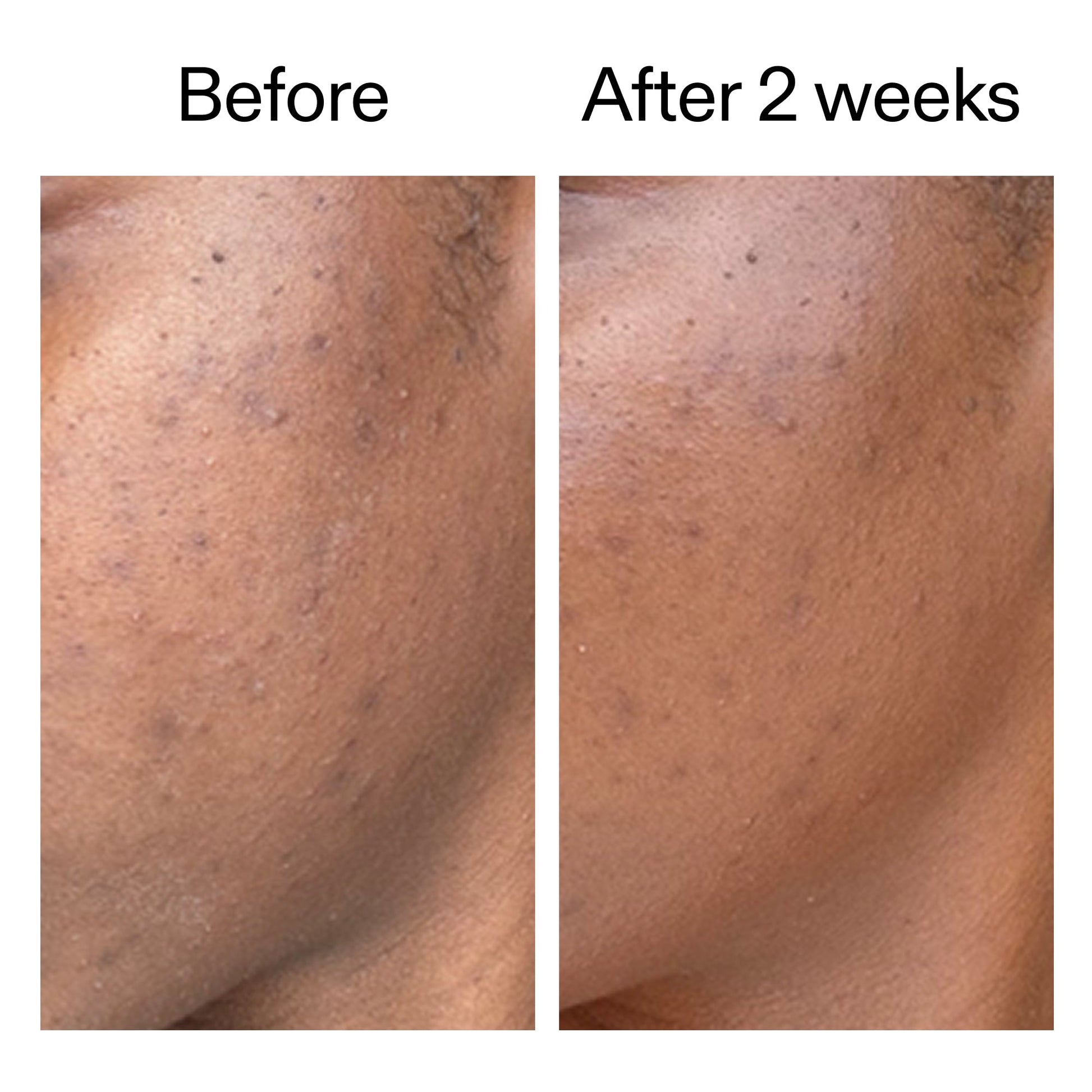 360-acne-clearing-serum-h0 DIOICB_A2000x2000.jpg
