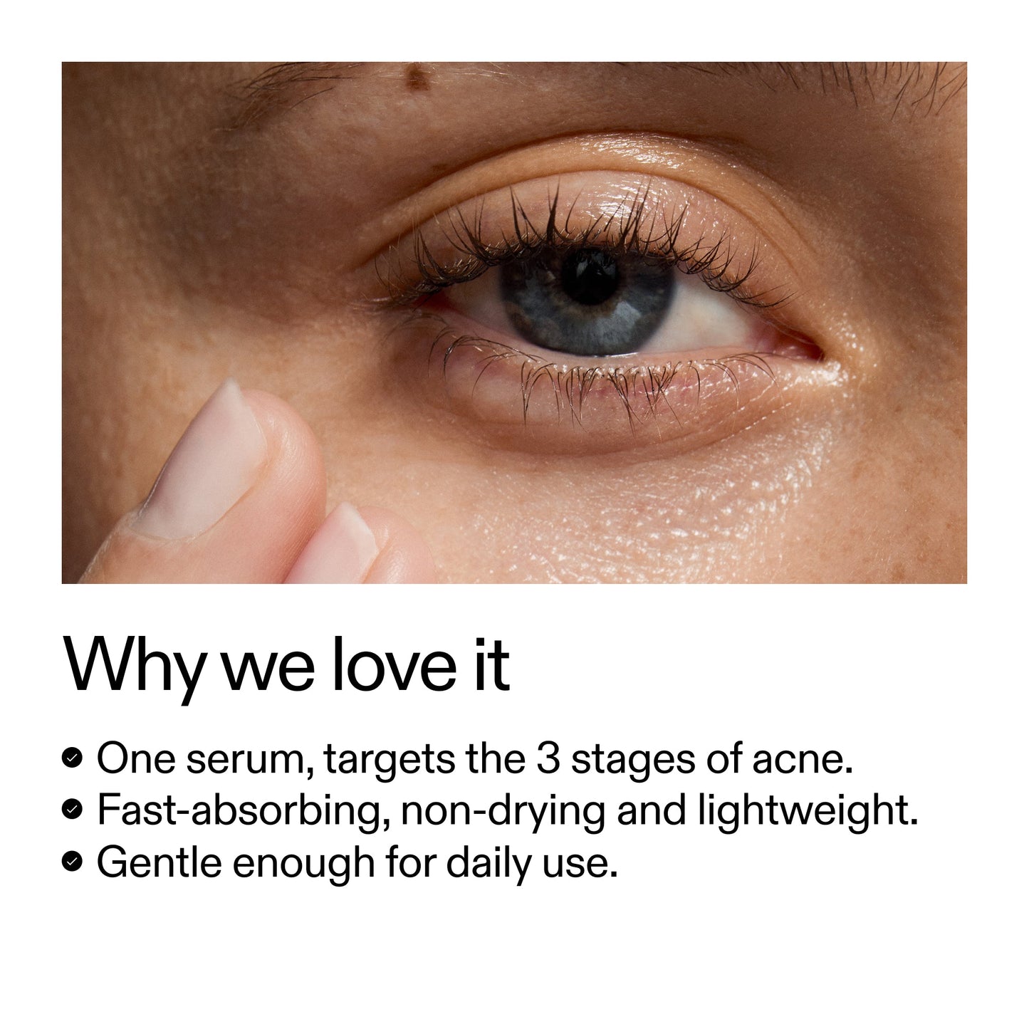360-acne-clearing-serum-h0 Dioic_Whyweloveit_2000x2000_175aafd3-0cbe-403a-b317-a8362881bfe2.jpg