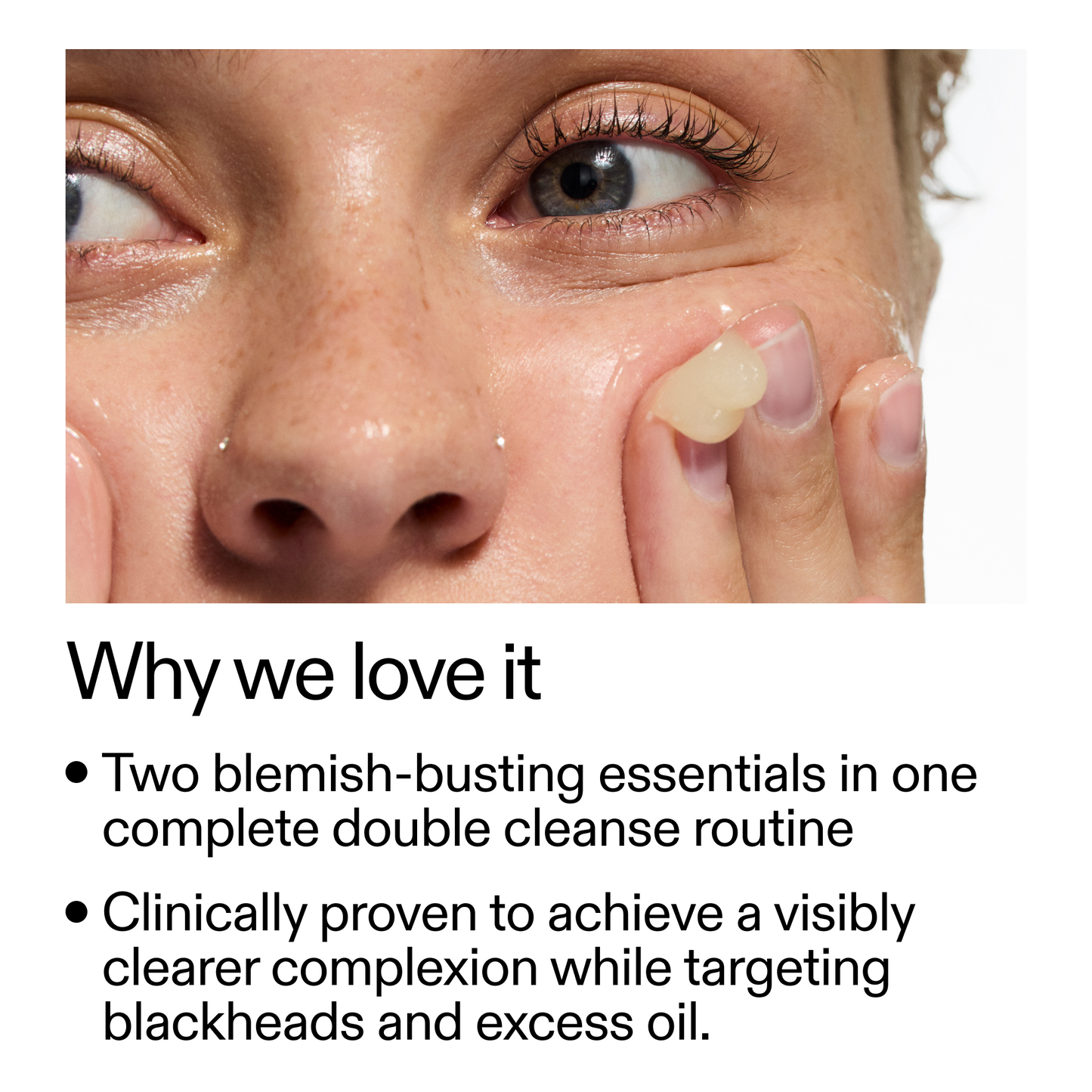 acne-double-cleanse-duo-j4 Double_Cleanse_Duo_for_Breakouts_Why_We_2000x2000_f242cb12-bb5c-487c-b203-071ccb406ec5.png