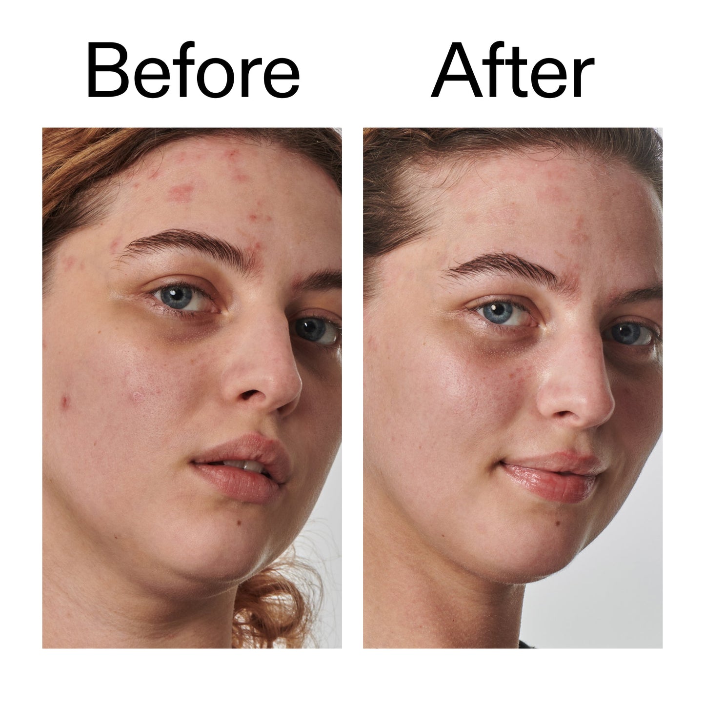 10-urea-moisturizer-a1 Dry_and_Rough_Skin_Solution_Before_After_2000x2000_efa6e639-5c39-49bd-a5dd-f0220293120a.jpg