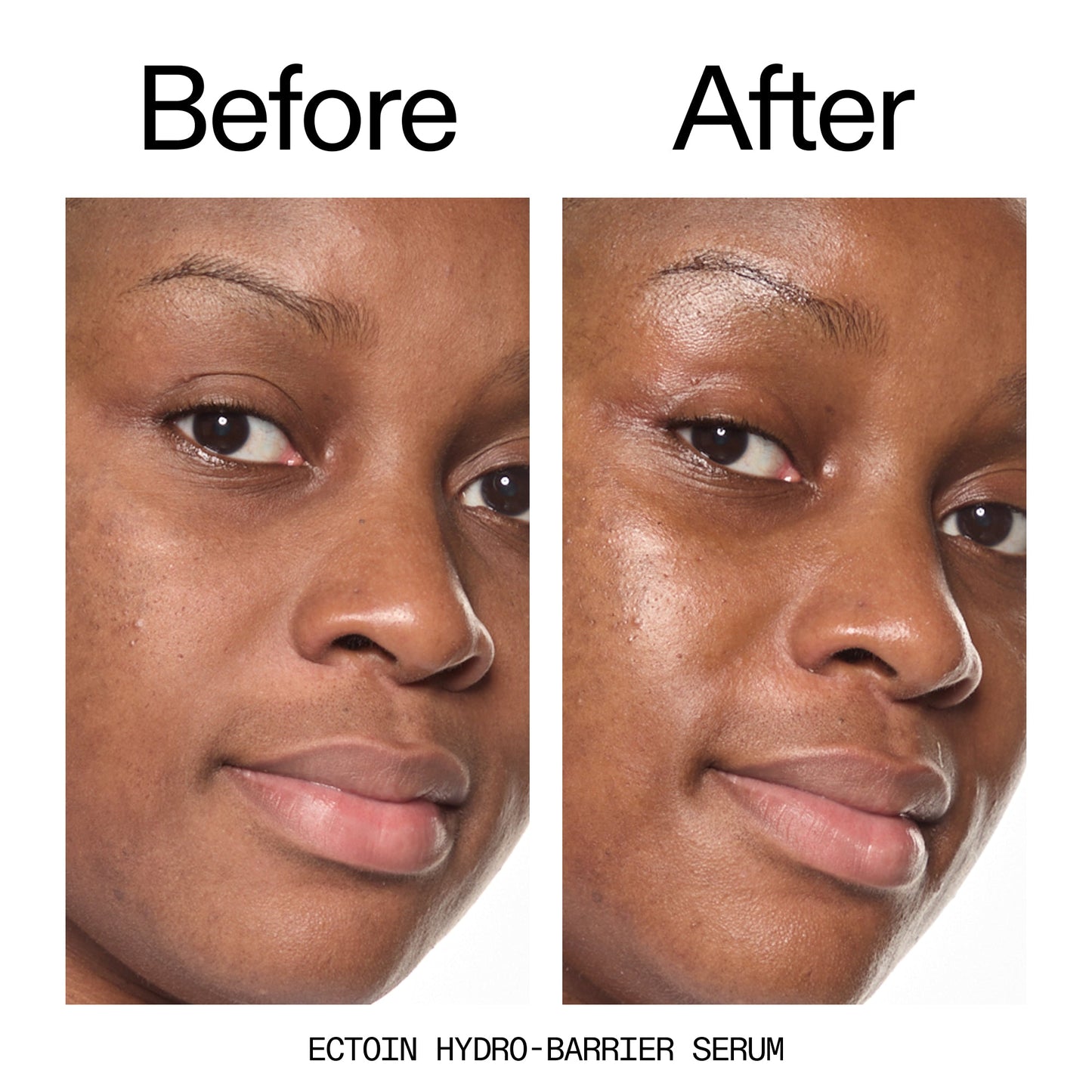 barrier-boosting-trio-h4 Ectoin_Before_After_2000x2000_ce35bc41-4da0-4b6f-adc7-29f8641f6c6c.jpg