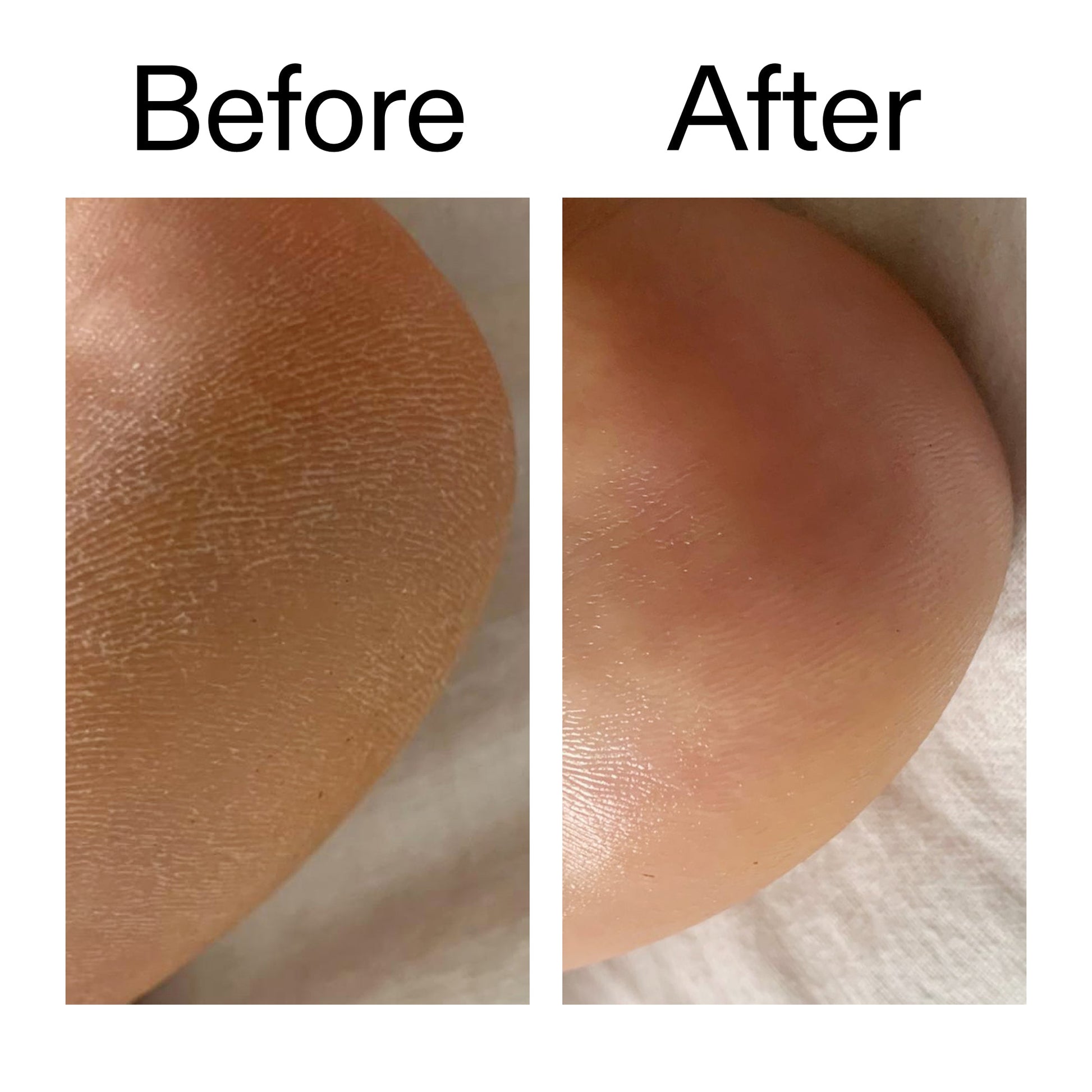 glycolic-acid-exfoliating-body-stick-duo-q1 Glycolic_Acid_Exfoliating_Body_Stick_Before_After_V1_2000x2000_a3043625-9400-429a-a7fb-d6dbd220f722.jpg