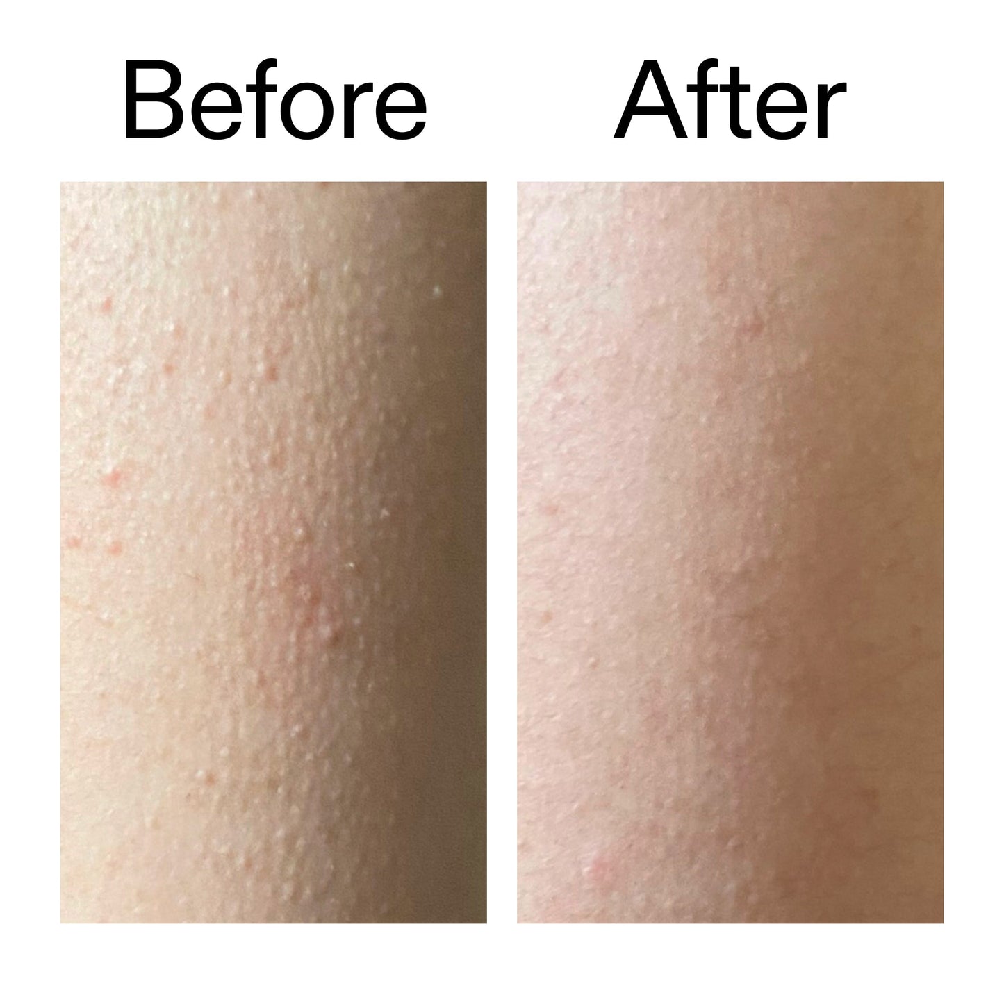glycolic-acid-exfoliating-body-stick-duo-q1 Glycolic_Acid_Exfoliating_Body_Stick_Before_After_V2_2000x2000_2e4ba052-94f6-4d56-82df-7bdb5b2df7ae.jpg