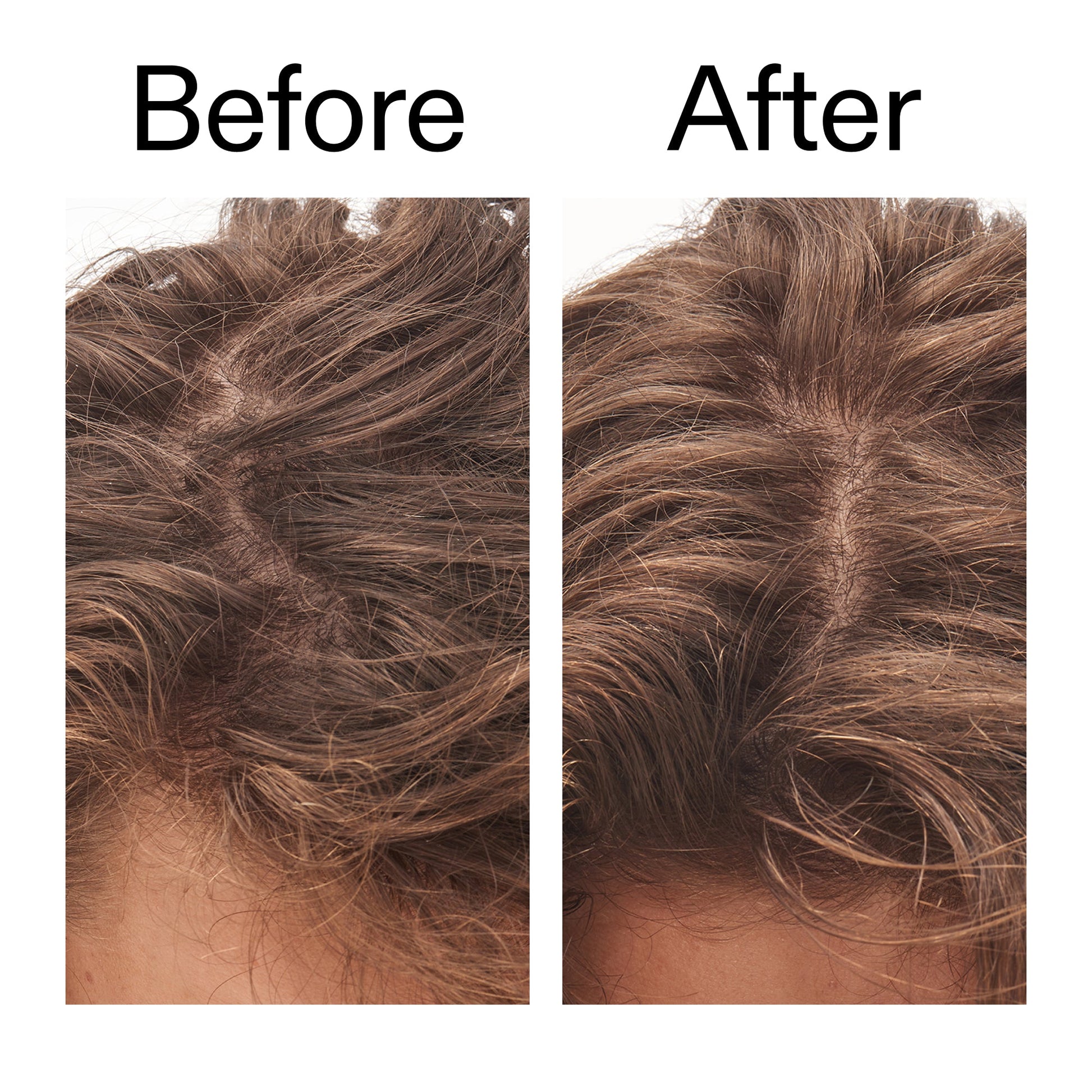 glycolic-acid-exfoliating-scalp-scrub-g7 Glycolic_Acid_Exfoliating_Scalp_Scrub_Before_After_2000x2000_b8561c87-05a1-4caa-80f7-1b6b33d750f7.jpg