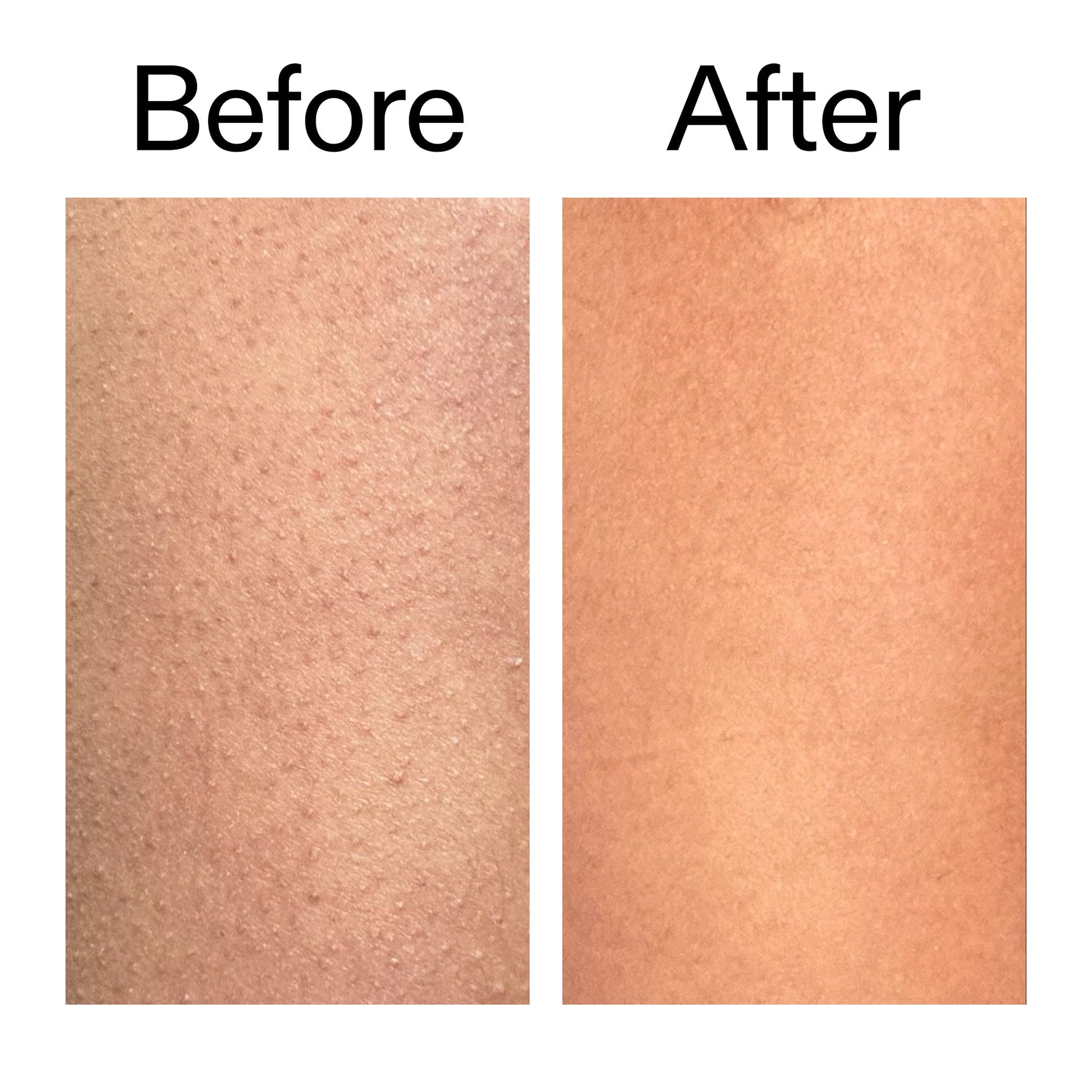 glycolic-acid-exfoliating-body-stick-n9 Glycolic_Body_Stick_B_A_2000x2000_6e6e6b4d-5bd7-43c0-aeed-4d66788e8995.jpg