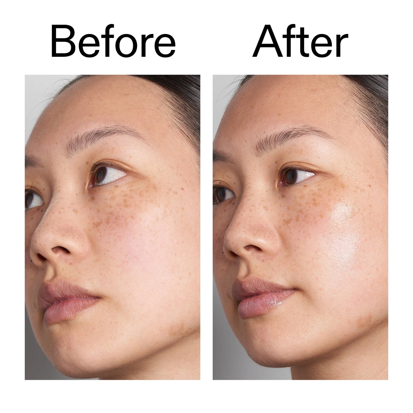 supersize-hyaluronic-acid-serum-100ml-p7 Hyaluronic_Acid_Before_After_2000x2000_d7983956-8aa2-4ea3-8255-c63e8d4f892e.jpg