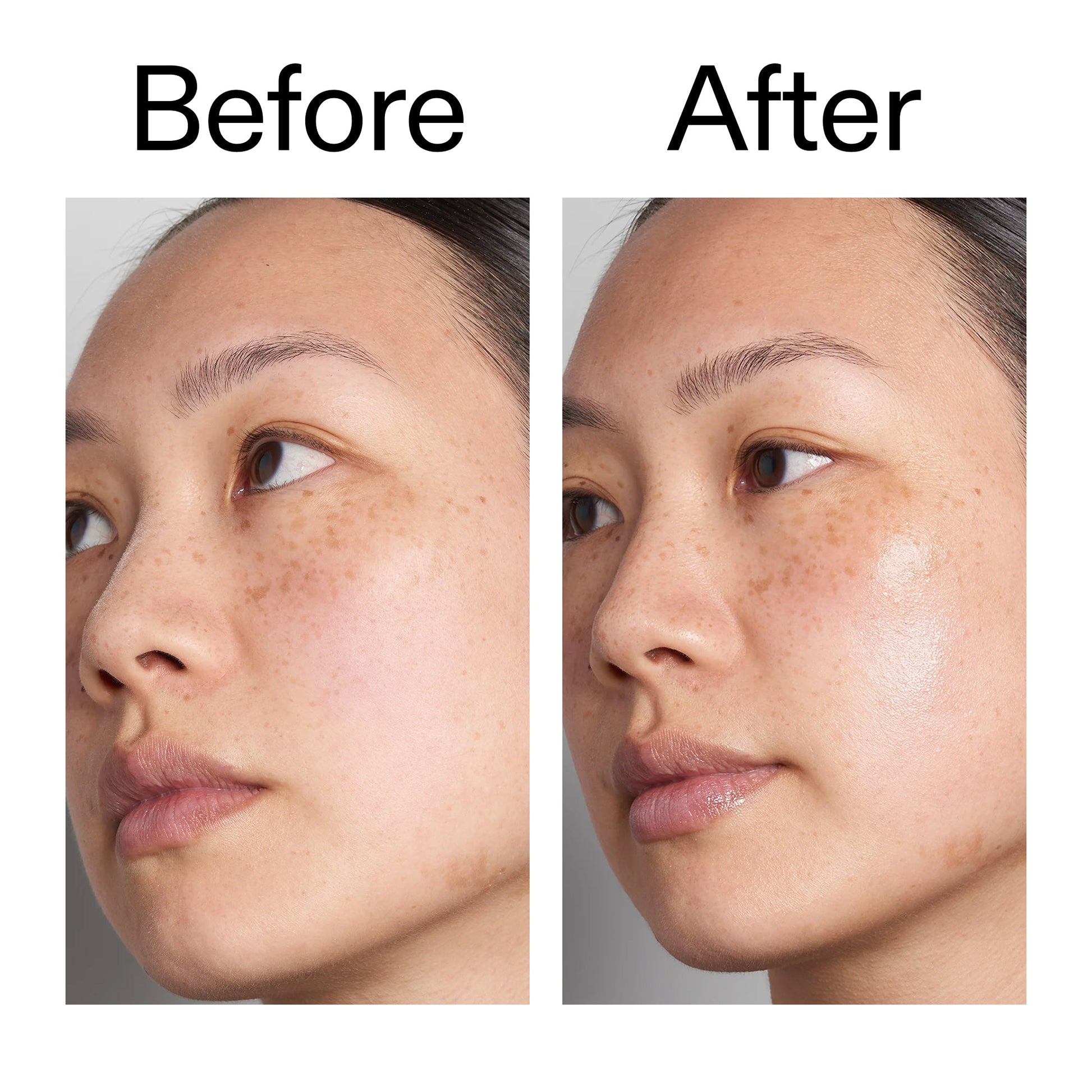 hyaluronic-acid-serum-60ml-s7 Hyaluronic_Acid_Before_After_2000x2000_d7983956-8aa2-4ea3-8255-c63e8d4f892e.jpg