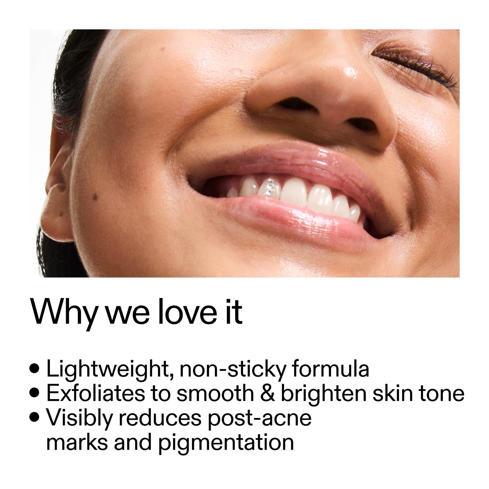 mandelic-acid-treatment-c3 Mandelic_Acid_Treatment_Why_we_love_it_2000x2000_6dfe29a9-2a79-464f-a5e8-e5ac37d93388.jpg