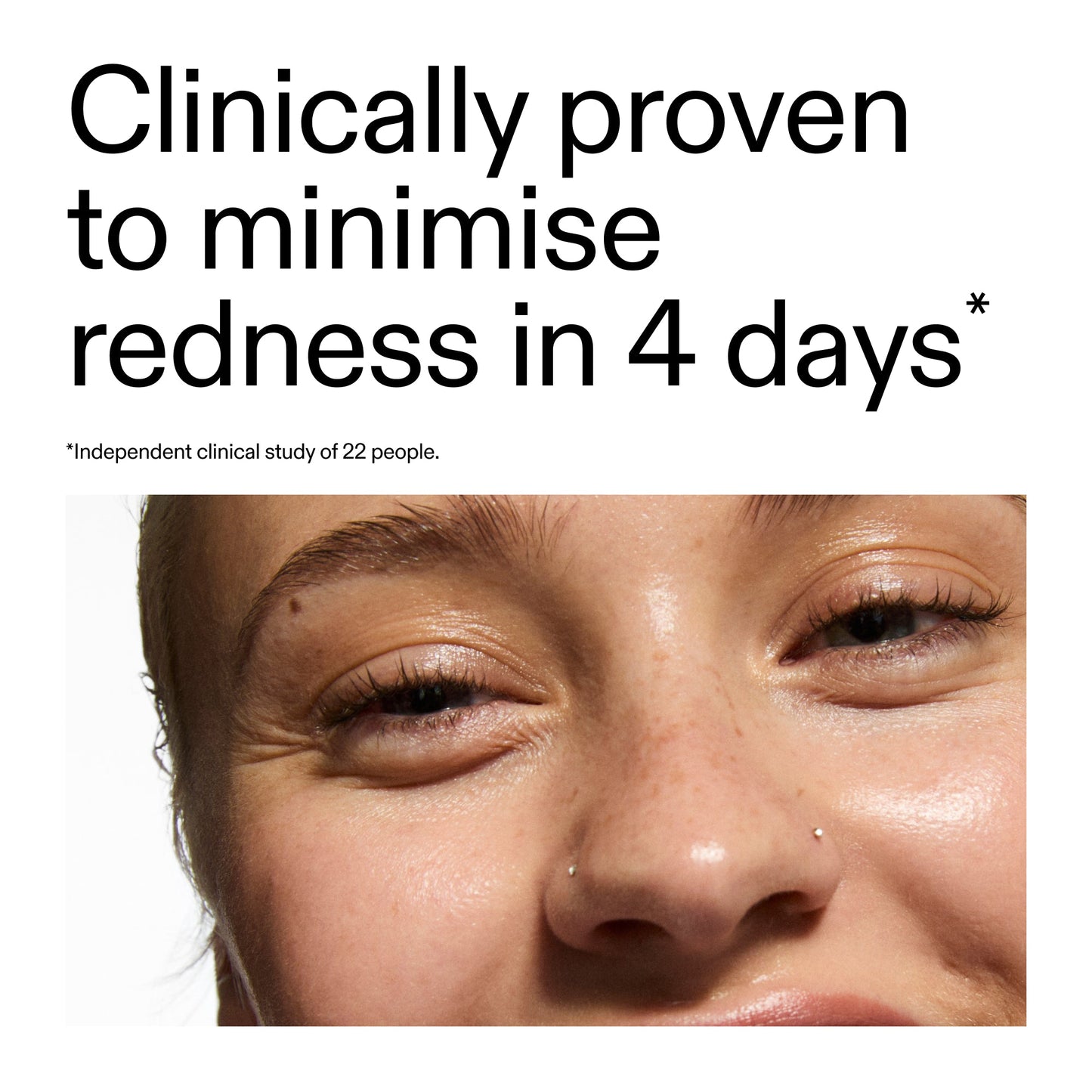 10-azelaic-acid-serum-for-redness-relief-j1 Oat_Cleansing_Balm_Claim_2000x2000_52a841dc-353c-4f2c-8646-3aadb604507d.jpg
