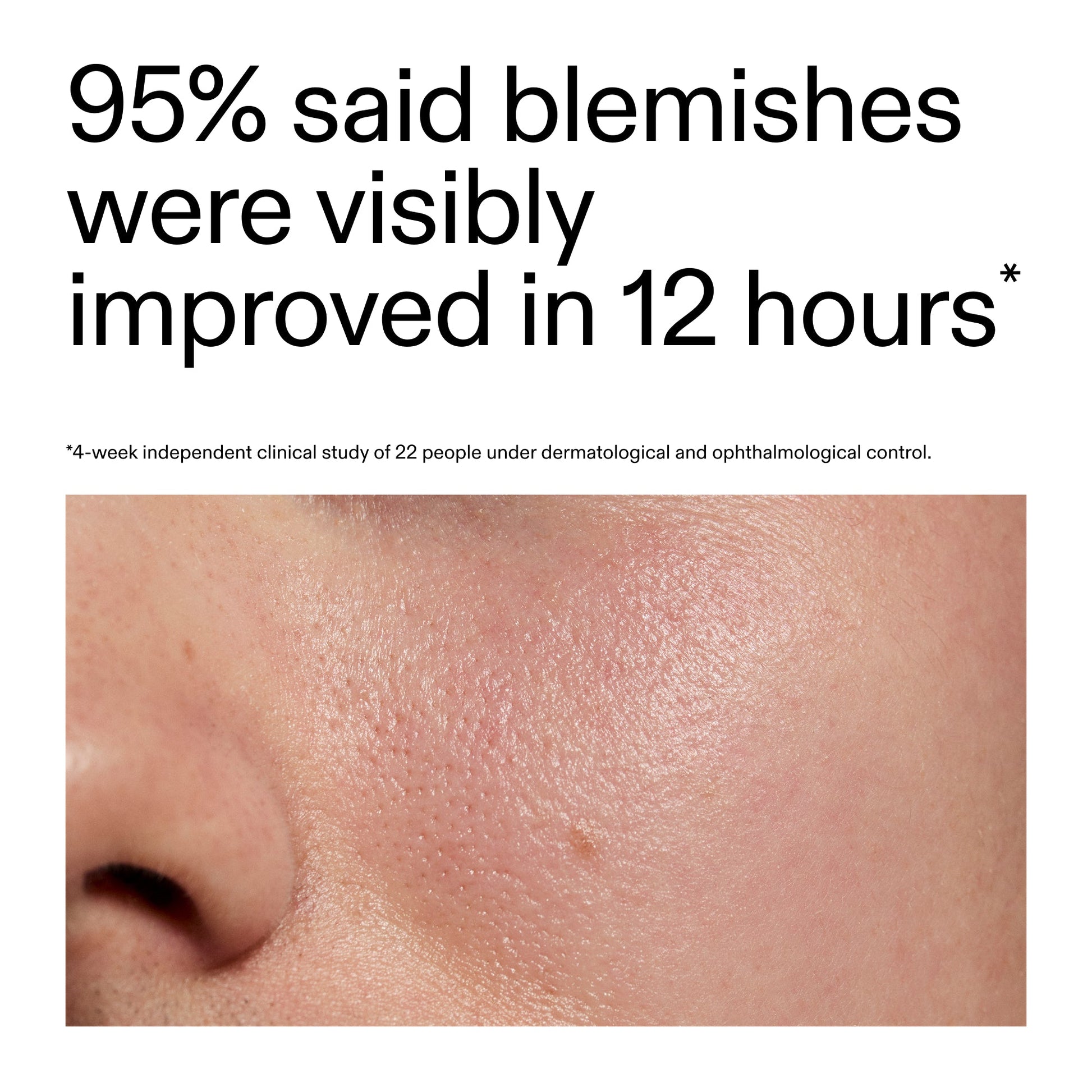 succinic-acid-acne-treatment-d0 Oat_Cleansing_Balm_Claim_2000x2000_ac6ce553-25db-41b2-a981-faae1ac4b8c0.jpg