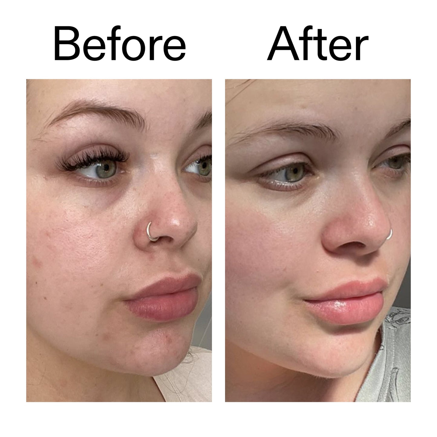 omega-water-cream-50ml-t9 Omega50_Before_After_2000x2000_46483ed8-3f9d-487f-9a0c-9df79830bd65.jpg