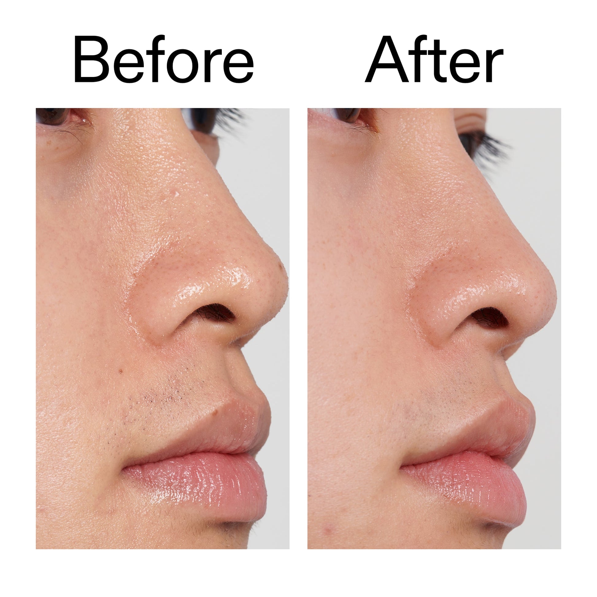 pha-toner-c0 PHA_Toner_Before_After_2000x2000_e3c10172-0150-4342-8b95-57417eaff50d.jpg