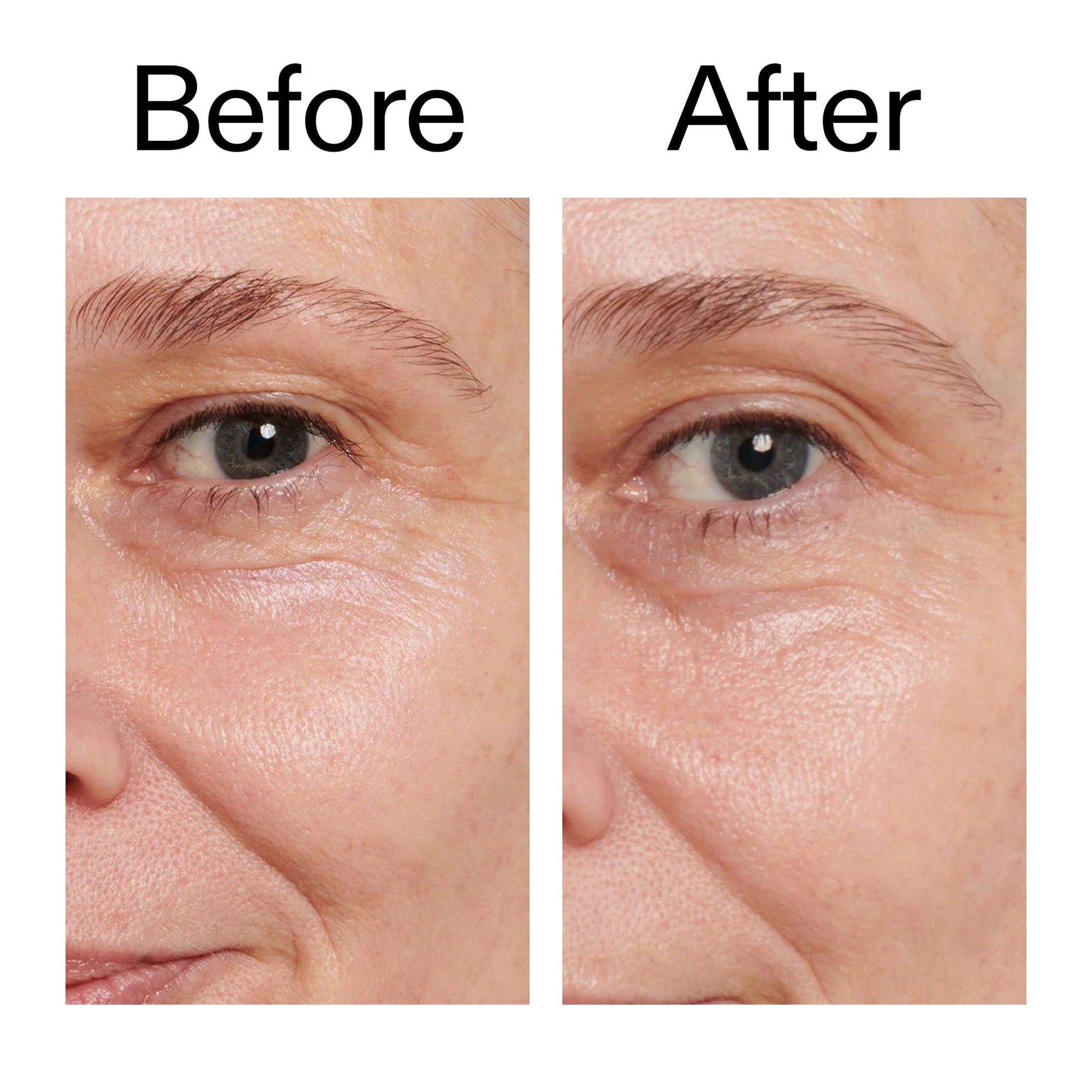 retinol-eye-cream-r8 Retinol_Eye_Cream_Before_After_2000x2000_ac03a80c-109e-4572-a95a-91dc109b4d27.jpg