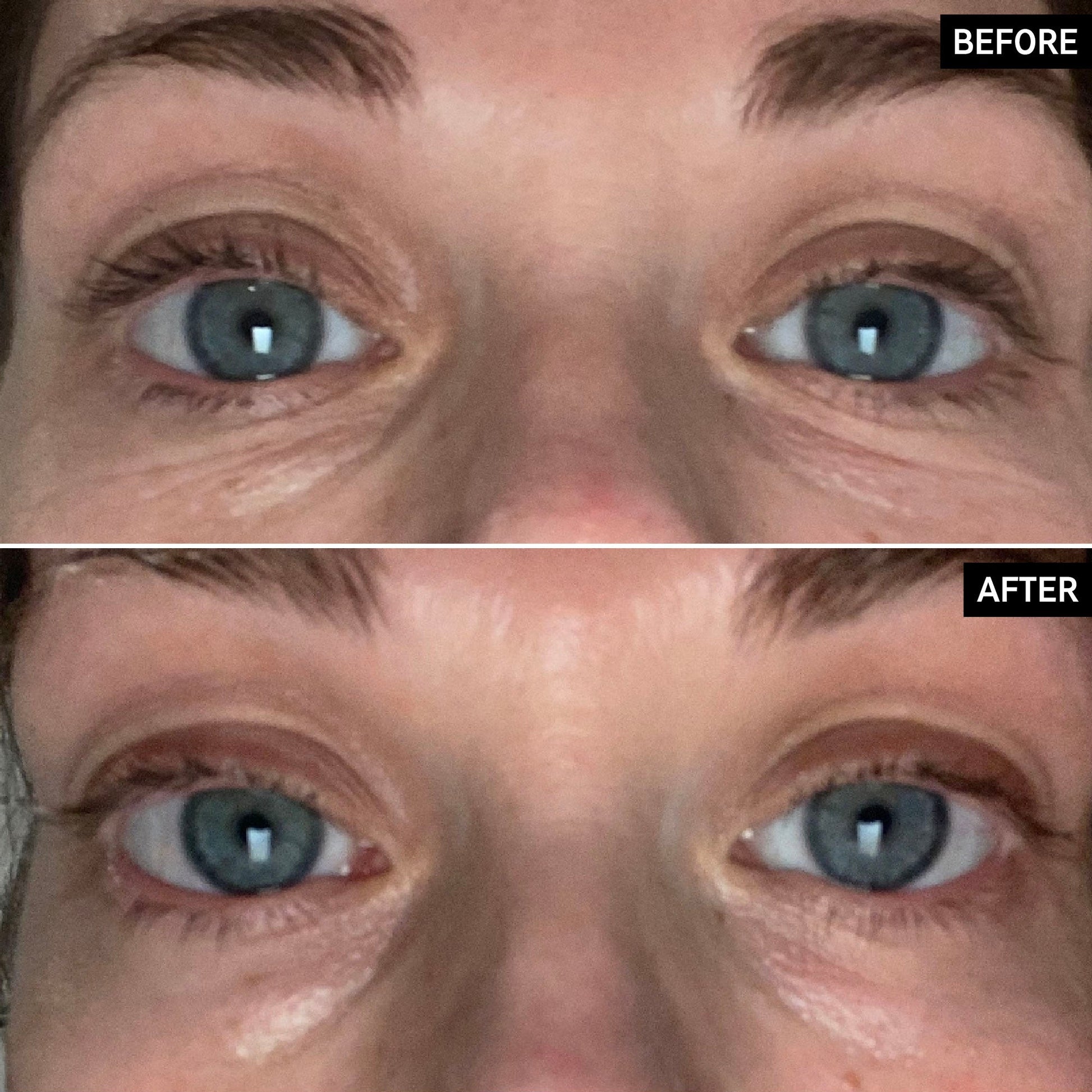 retinol-eye-cream-r8 SITE-UGCBAsApril_Nicole_B_A_PPage_2000x2000_1.jpg