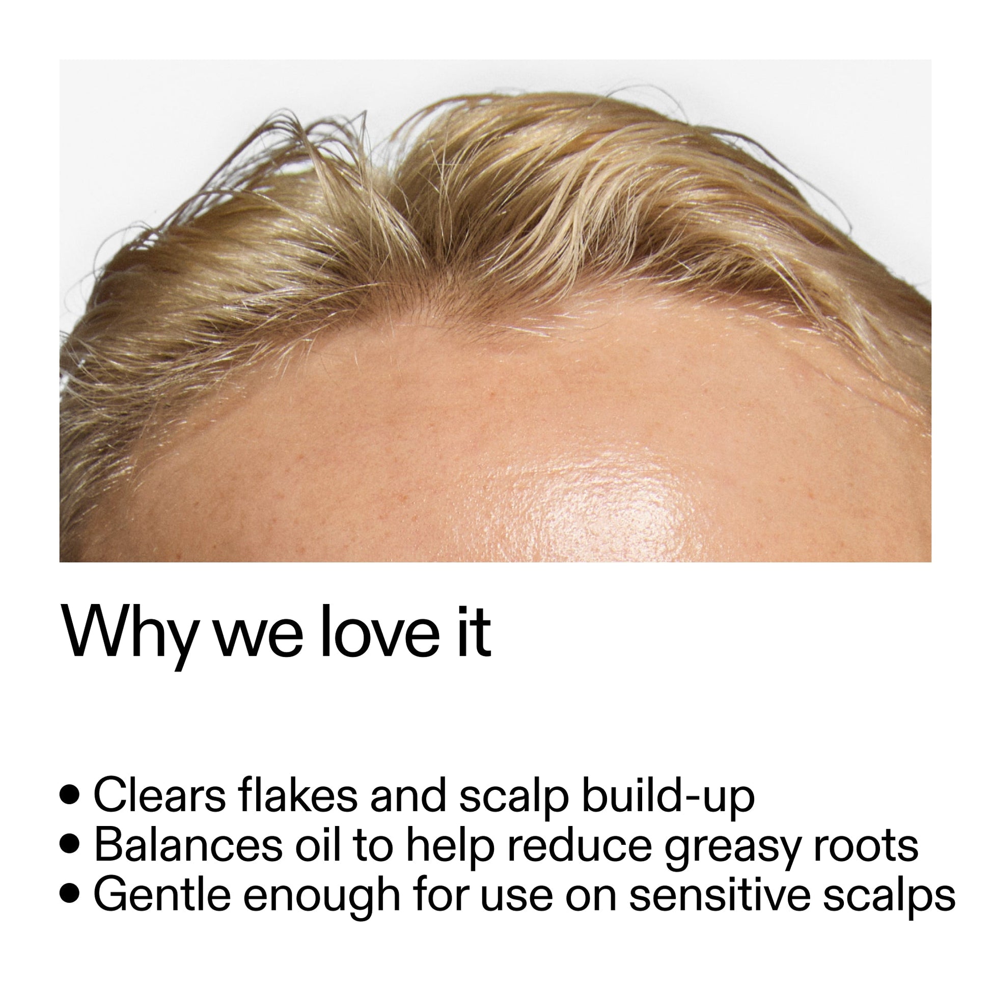 salicylic-acid-exfoliating-scalp-treatment-a6 Salicylic_Acid_Exfoliating_Scalp_Treatment_Why_we_love_it_2000x2000_44b6bd6d-9ec4-4b23-9dc4-bc3fd6f28e14.jpg