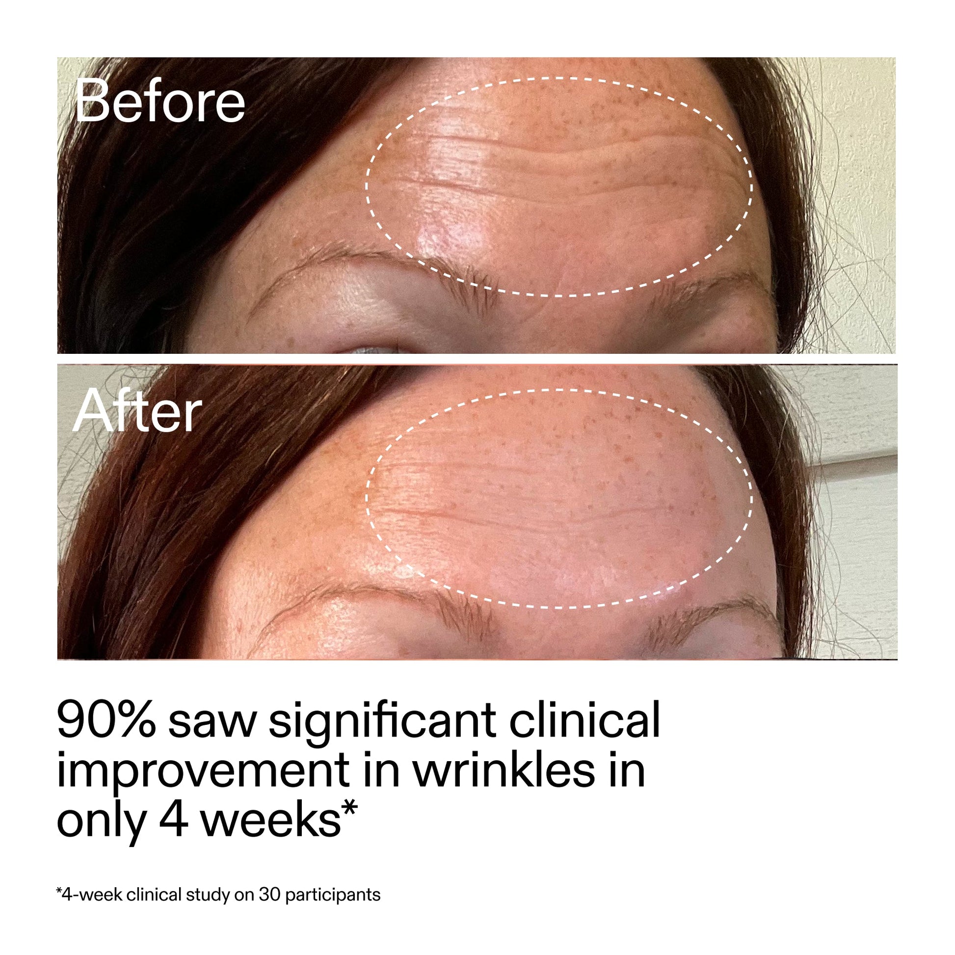 starter-retinol-serum-duo-y8 StarterRetinol_BeforeAfter_Claim1_2000x2000_03b4d6e5-a357-43b9-a855-aba5e35c57f3.jpg