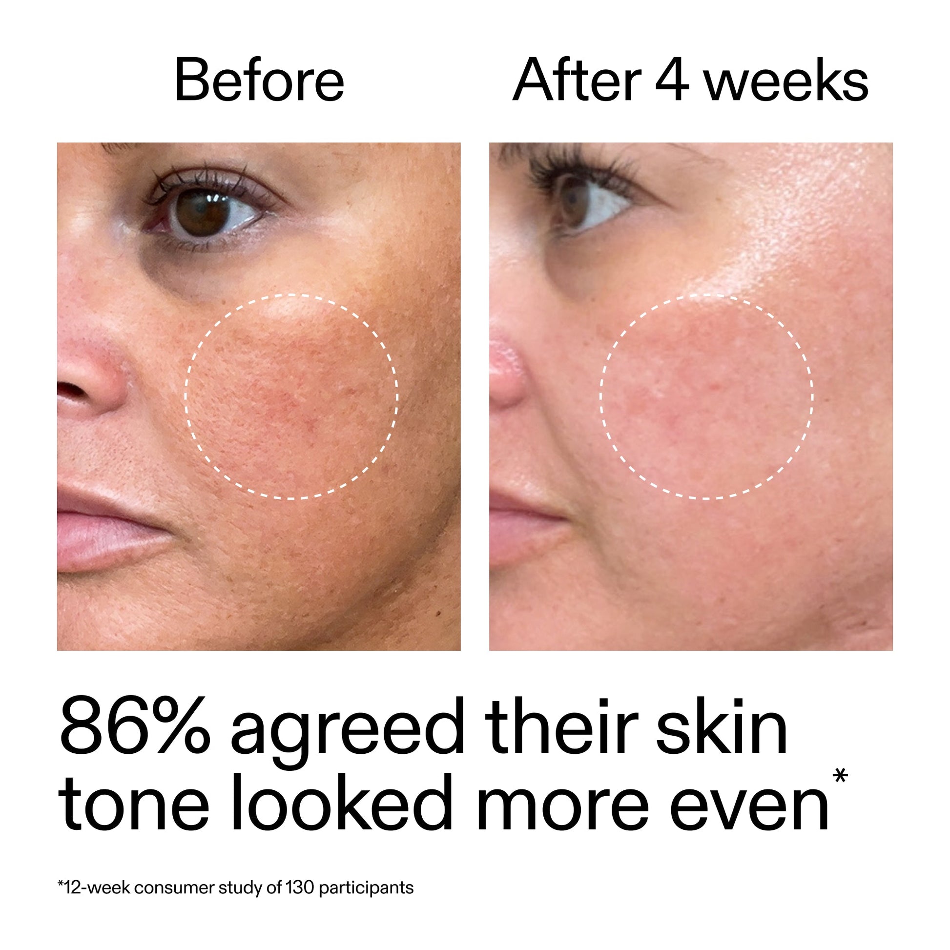 starter-retinol-serum-duo-y8 StarterRetinol_BeforeAfter_Claim2_2000x2000_fc5bb8ac-8588-478f-98d5-28af6651601a.jpg