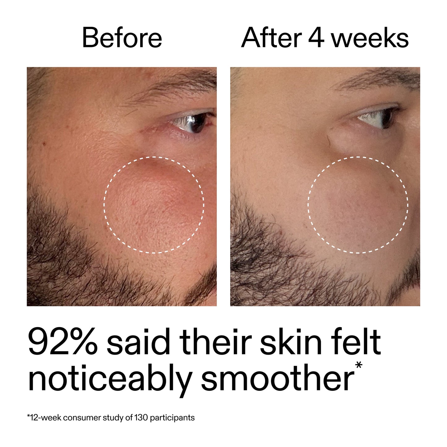 starter-retinol-serum-z9 StarterRetinol_BeforeAfter_Claim3_2000x2000_6ceab106-e0ee-4ed4-ba62-41bc39538038.jpg