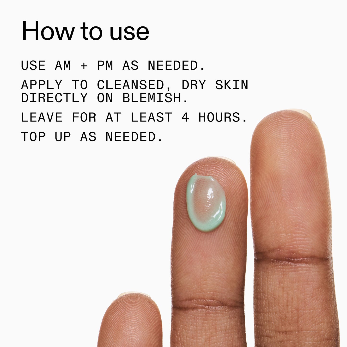succinic-acid-acne-treatment-d0 Succinic_Acid_Treatment_How_to_Use_2000x2000_d57137d5-d7f1-427c-9a46-5fc00c19c542.jpg
