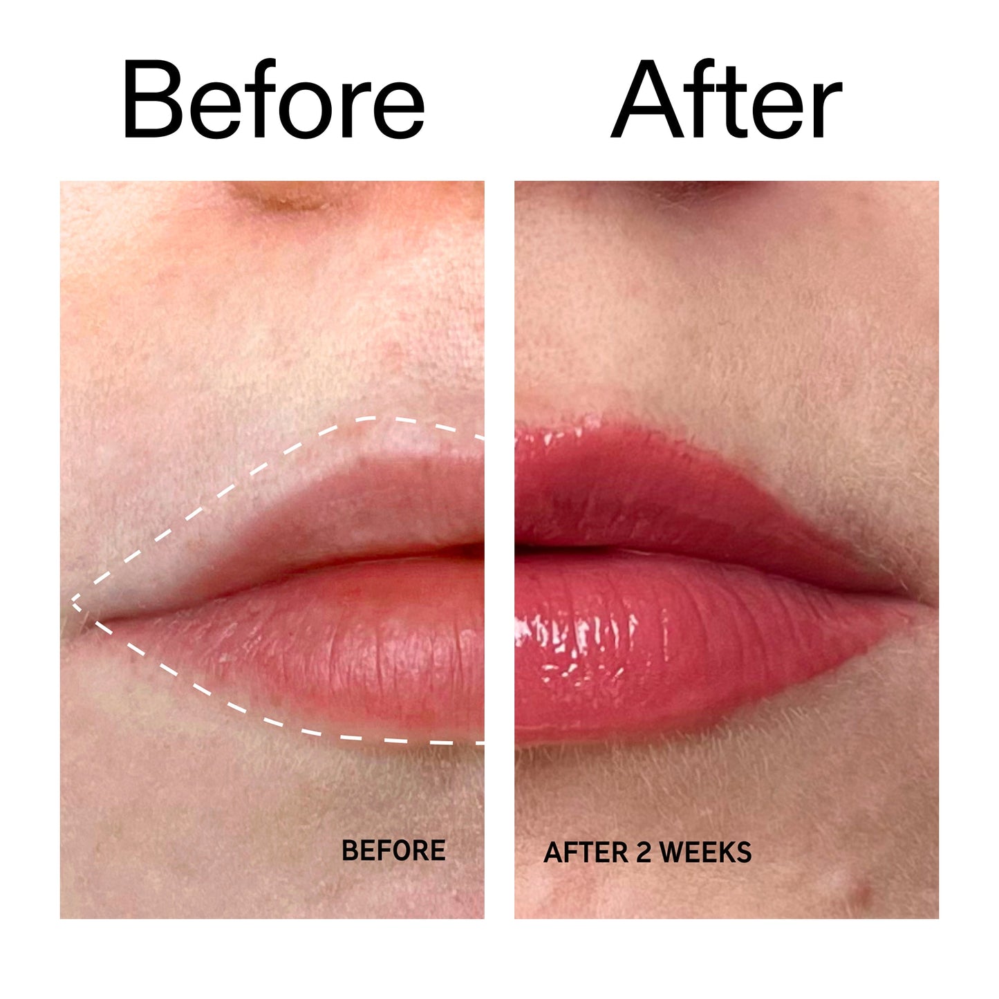 tripeptide-plumping-berry-lip-balm-e6 Tripeptide_Plumping_Lip_Balm_-_Berry_Before_After_2000x2000_9474bbd8-43ca-4b0e-b0e7-dfab70b91927.jpg