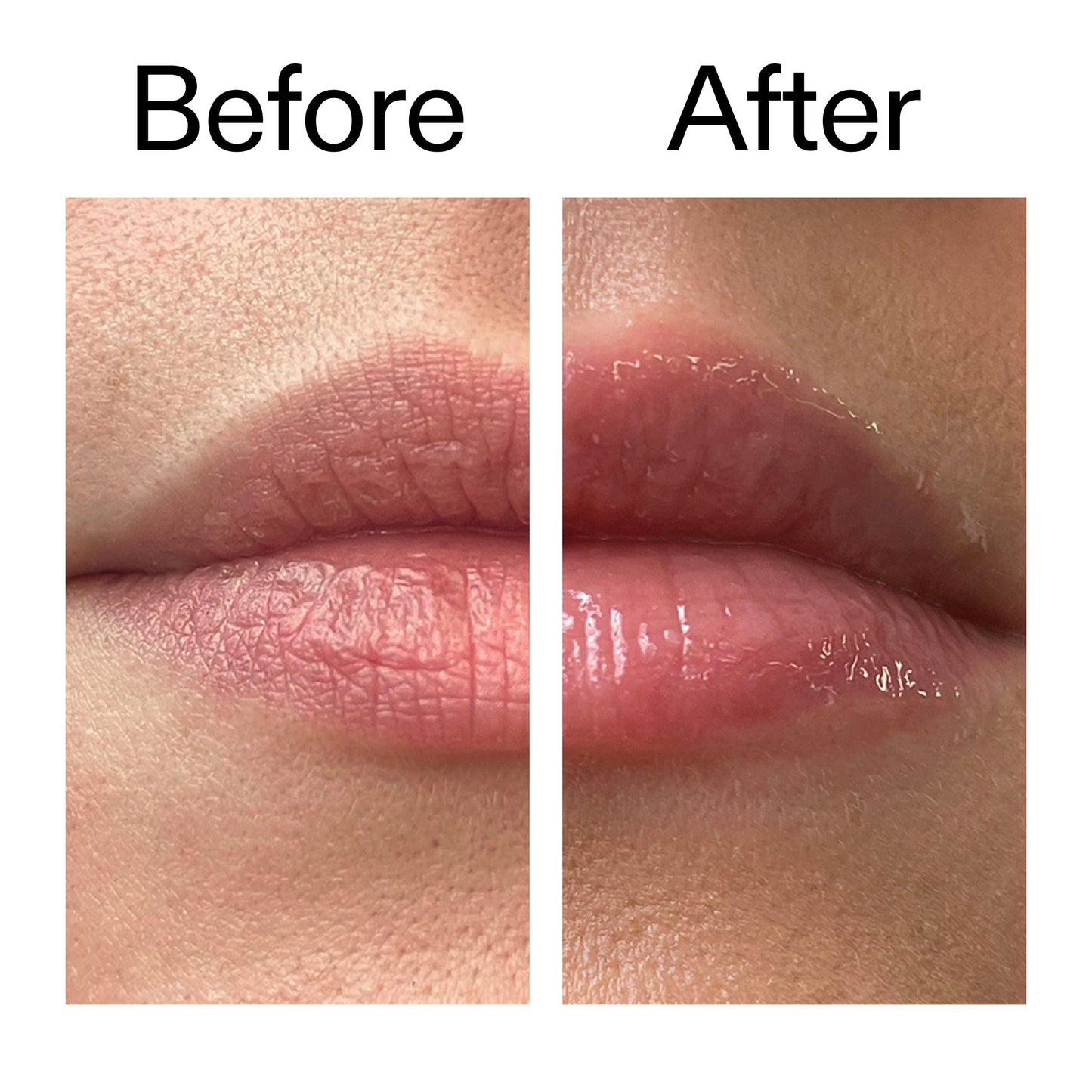 lip-plumping-duo-q8 Tripeptide_Plumping_Lip_Balm_Before_After_2000x2000_b4a5ee04-d2ac-4857-8f01-17209acc4bf3.jpg