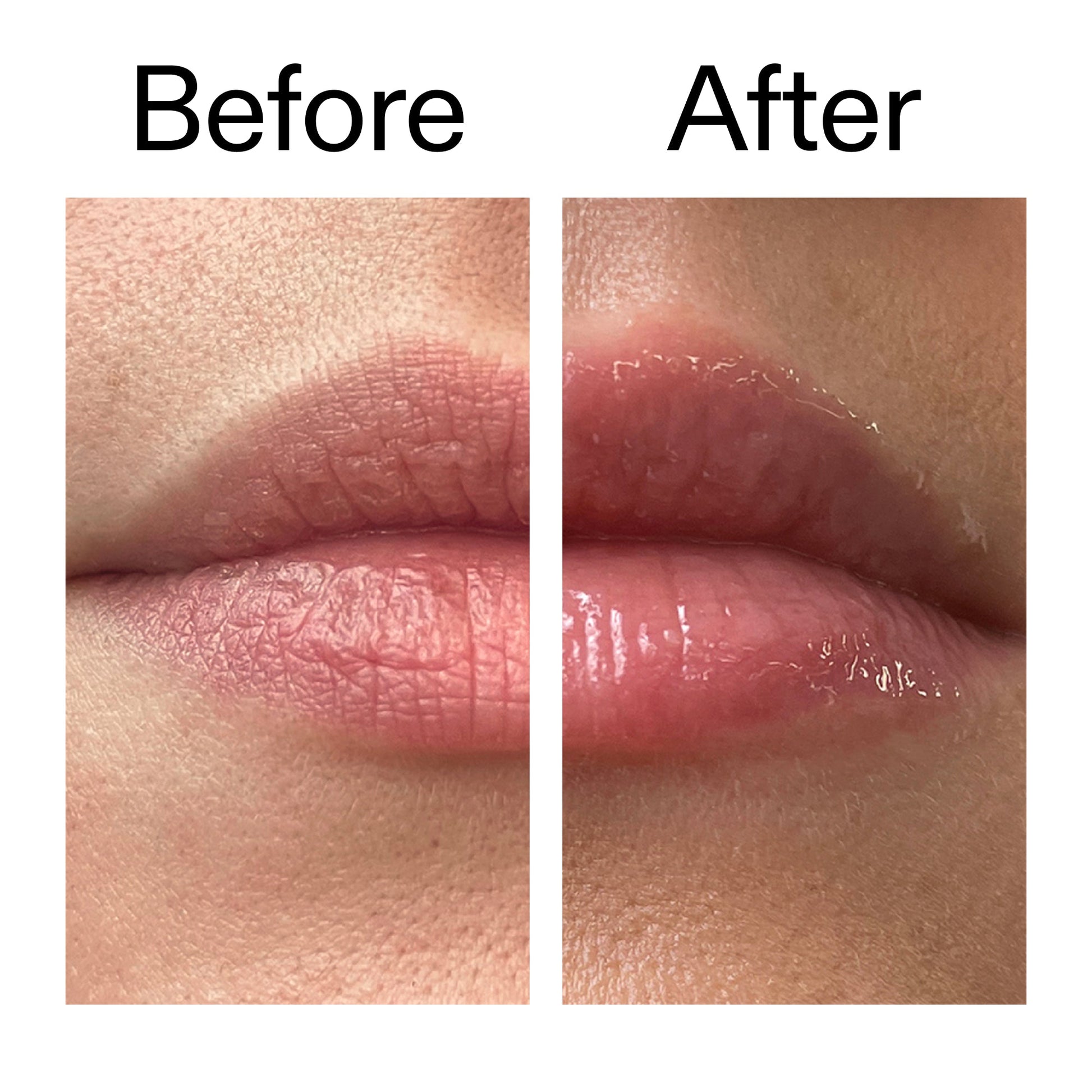 lip-plumping-duo-q8 Tripeptide_Plumping_Lip_Balm_Before_After_2000x2000_b4a5ee04-d2ac-4857-8f01-17209acc4bf3.jpg
